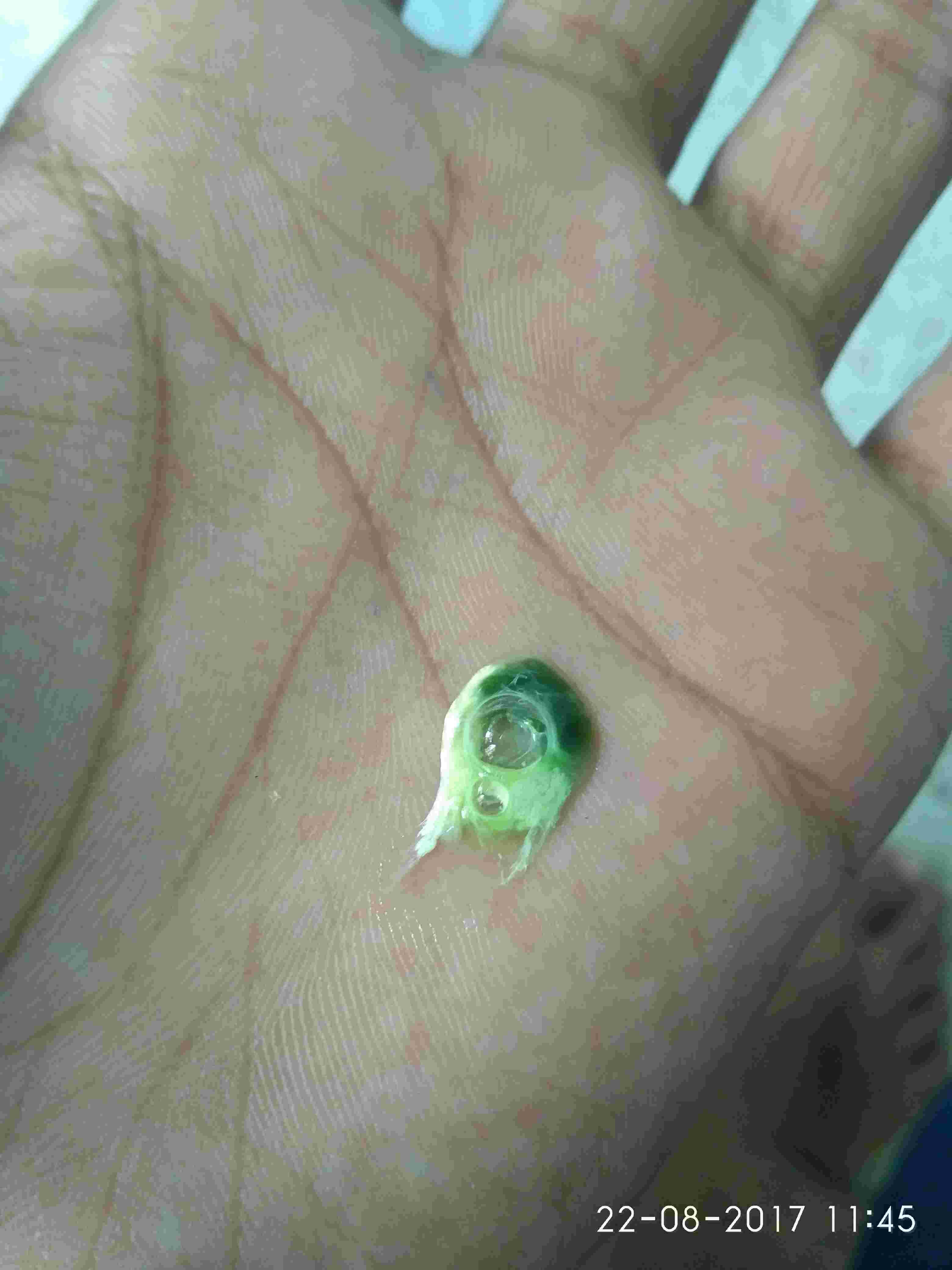 Question details sensitive content