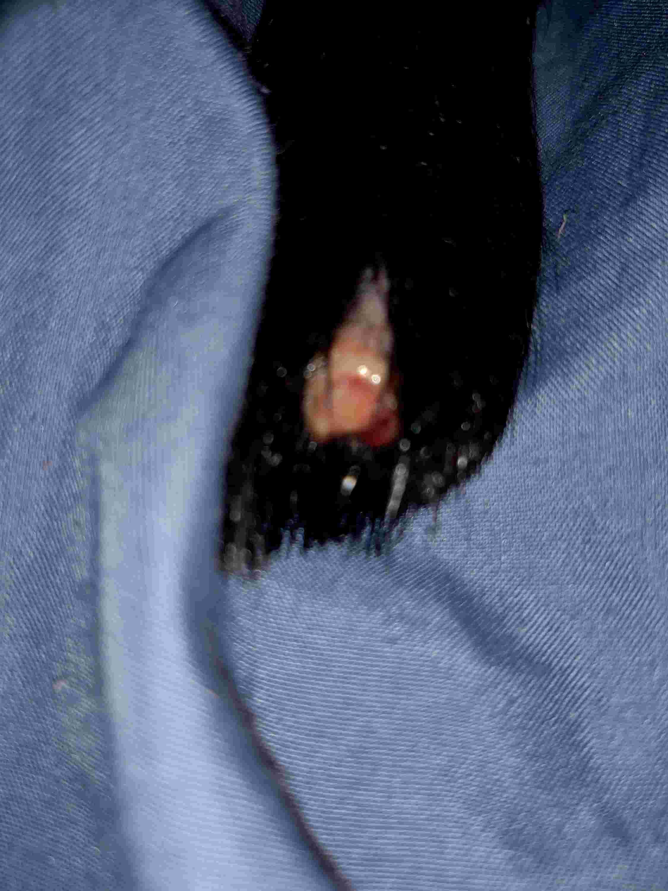 Question details sensitive content