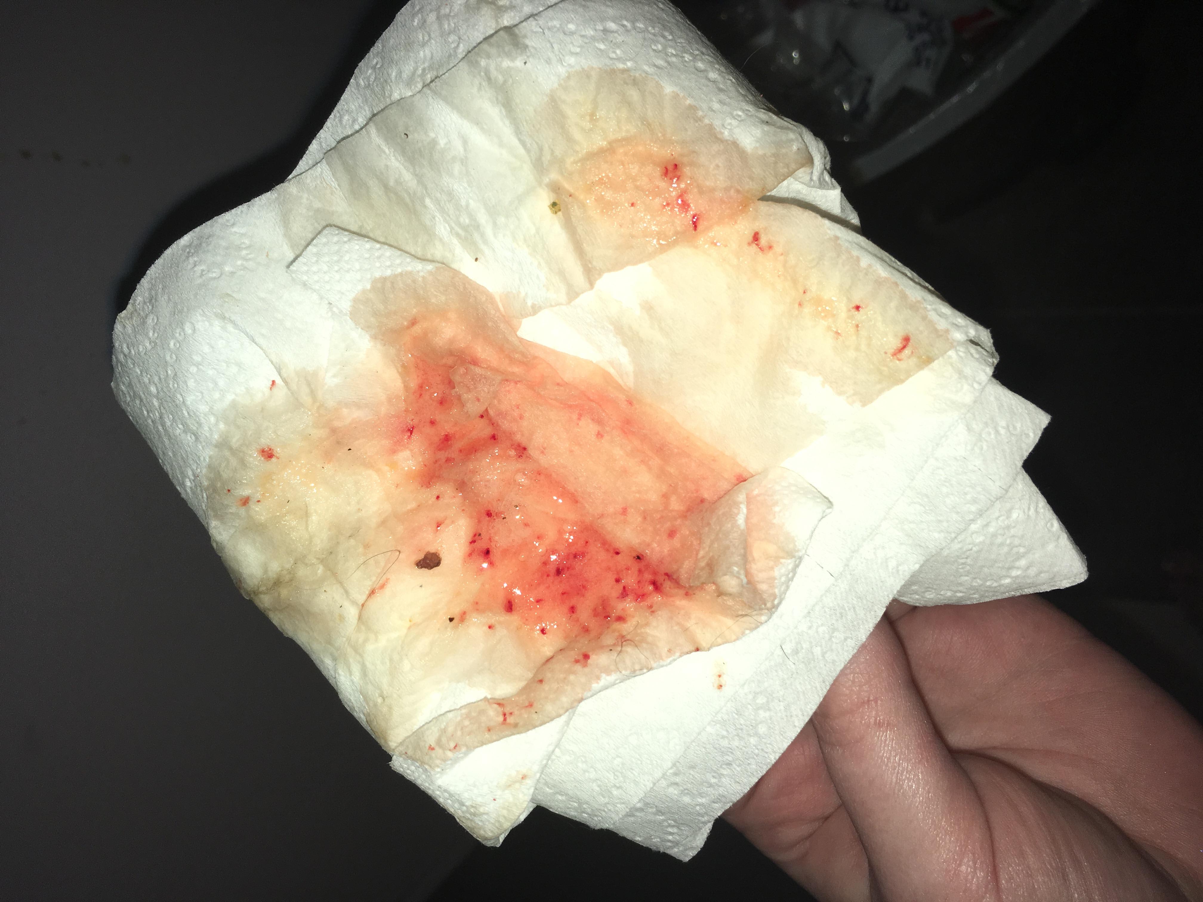 Question details sensitive content