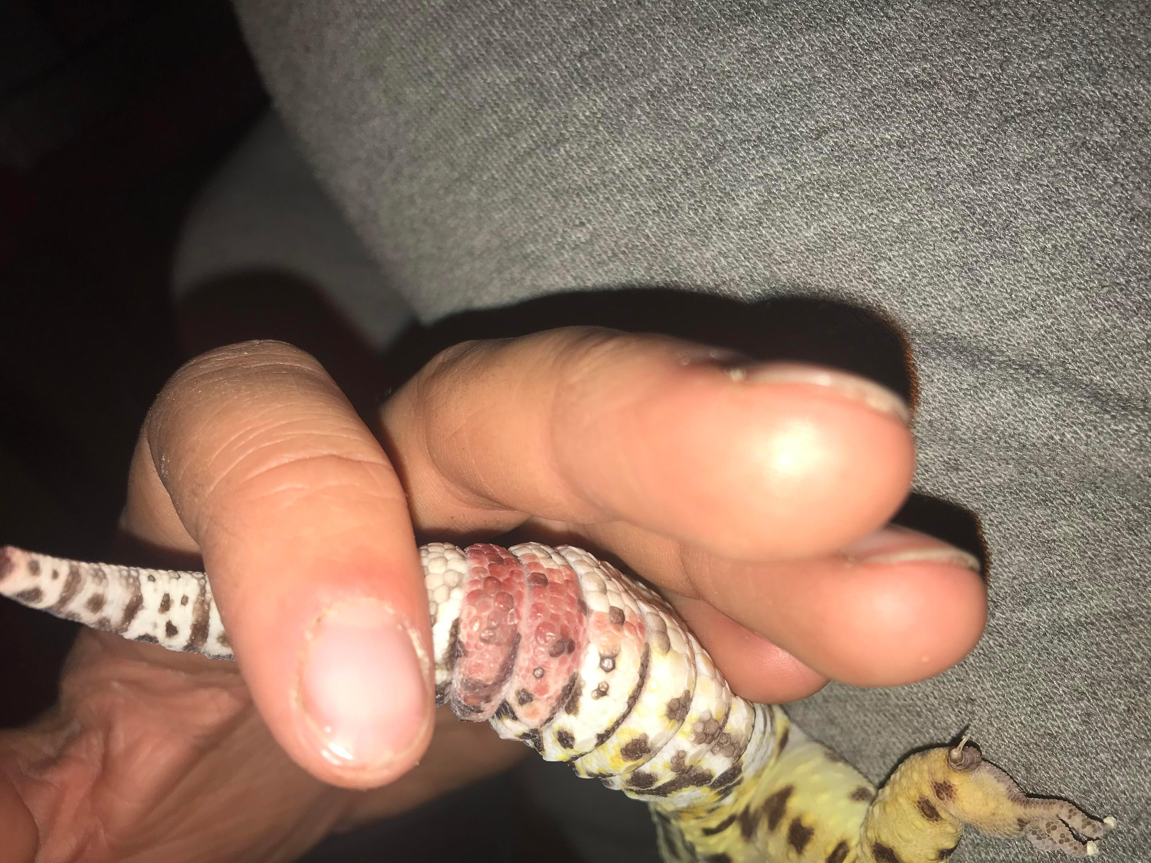 Question details sensitive content