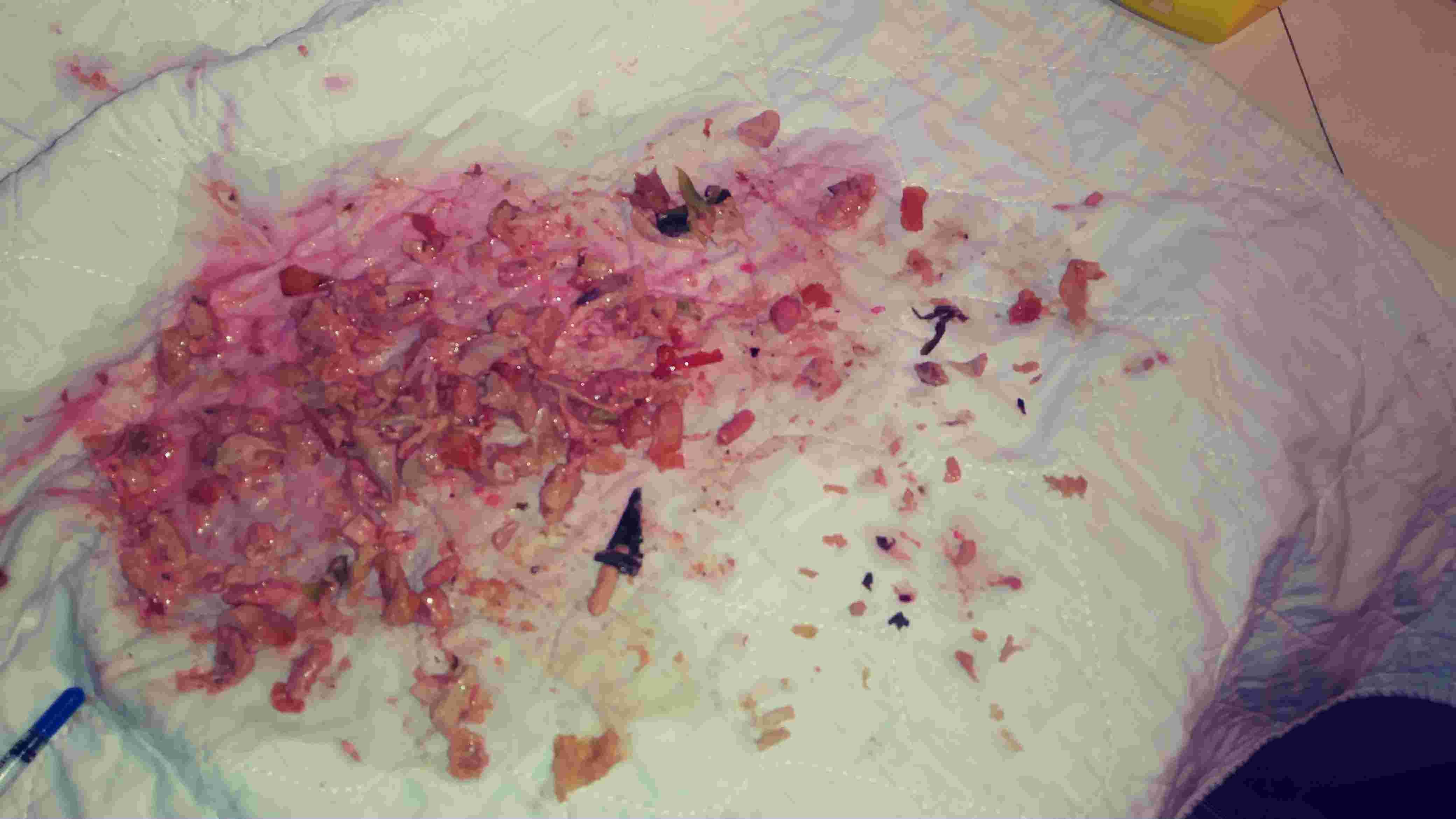 Question details sensitive content