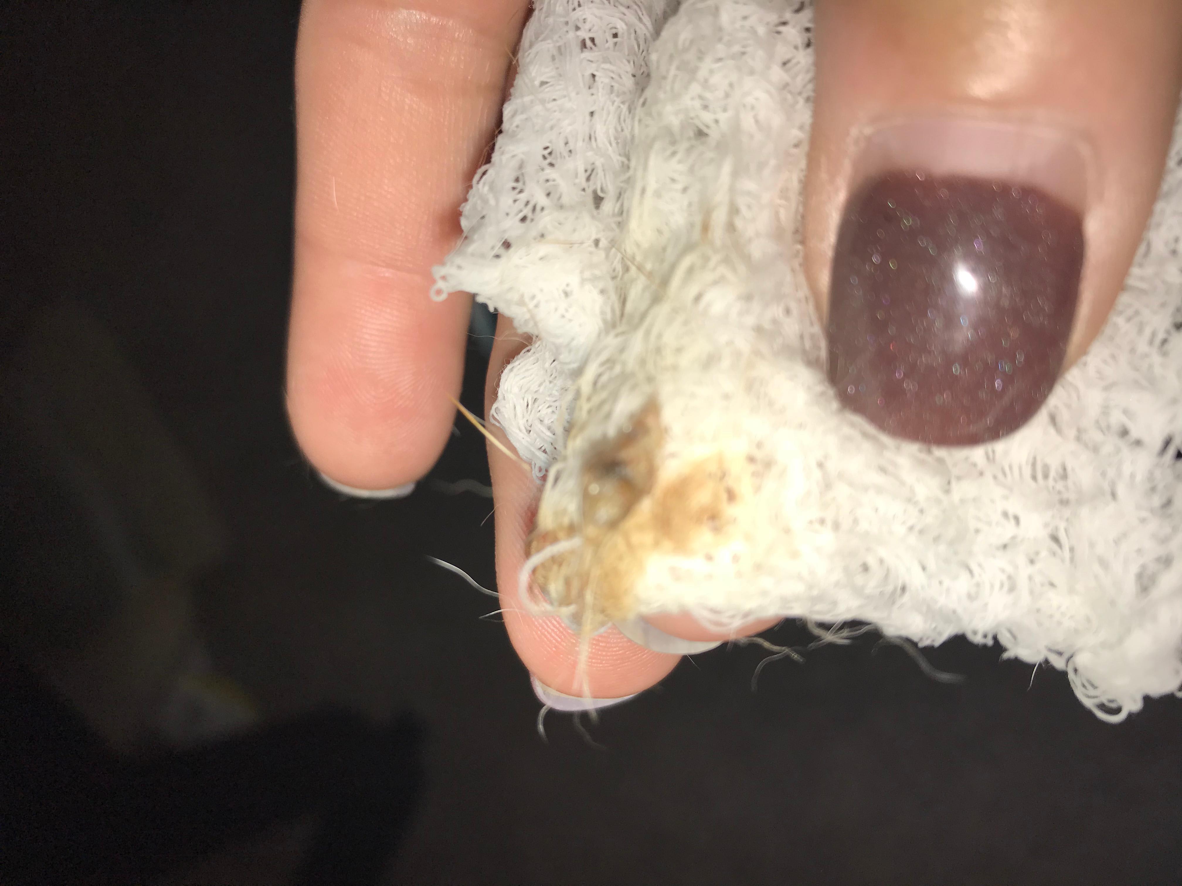 Question details sensitive content