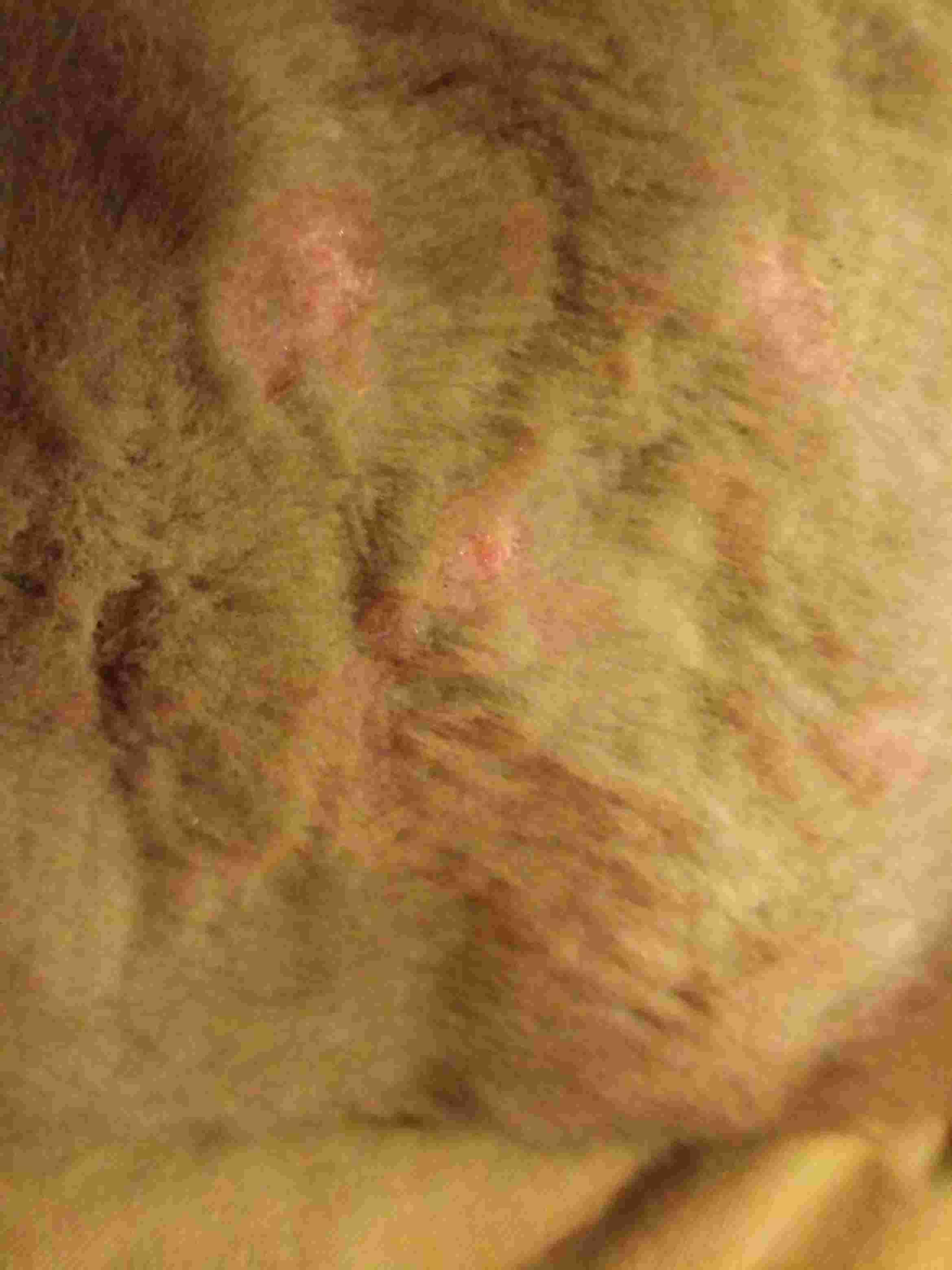 Question details sensitive content