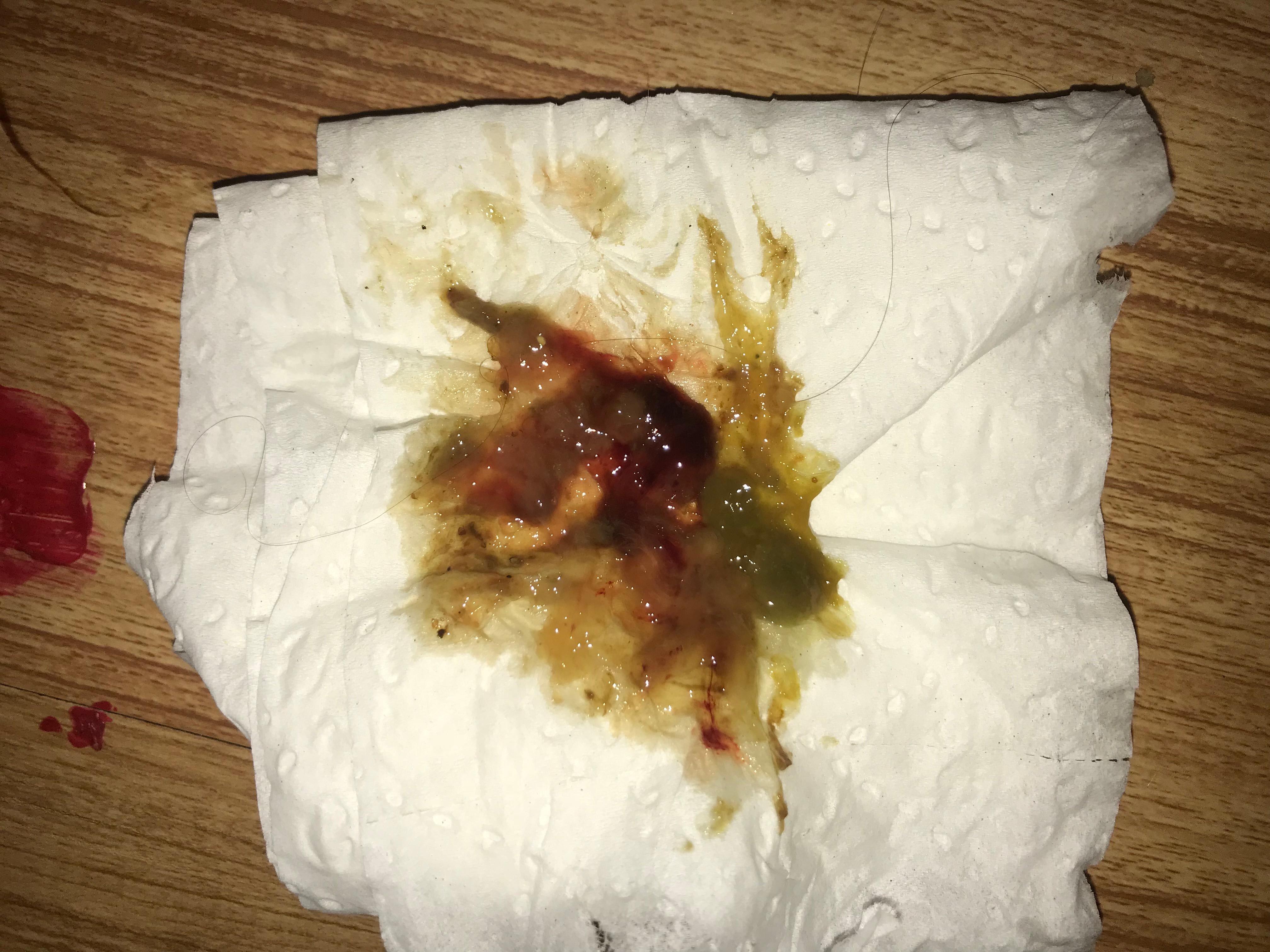 Question details sensitive content