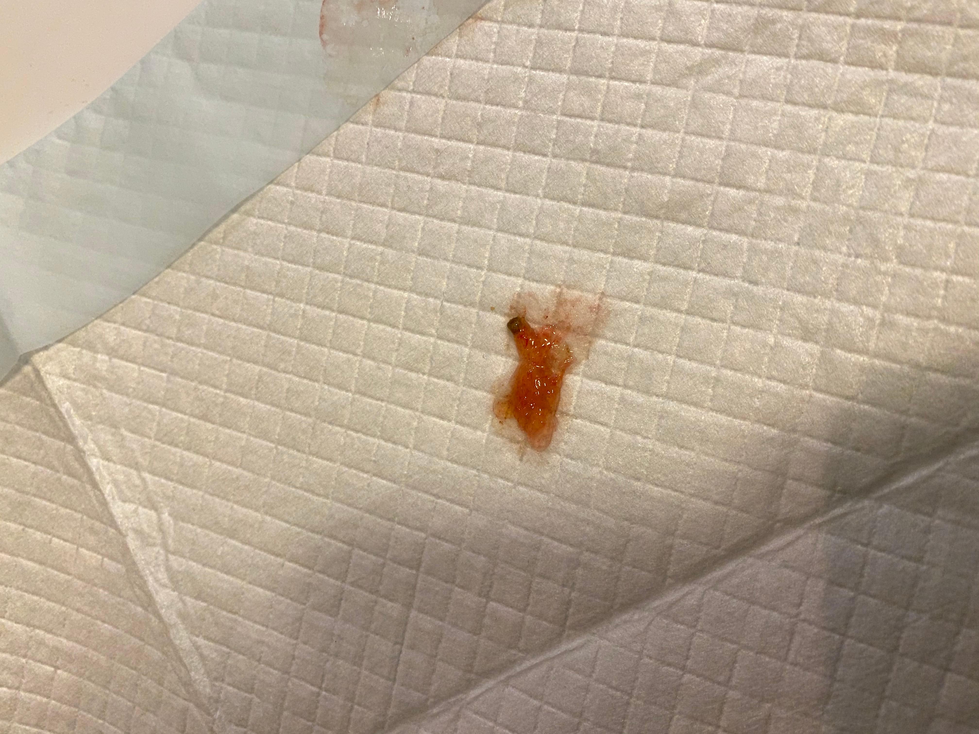 Question details sensitive content