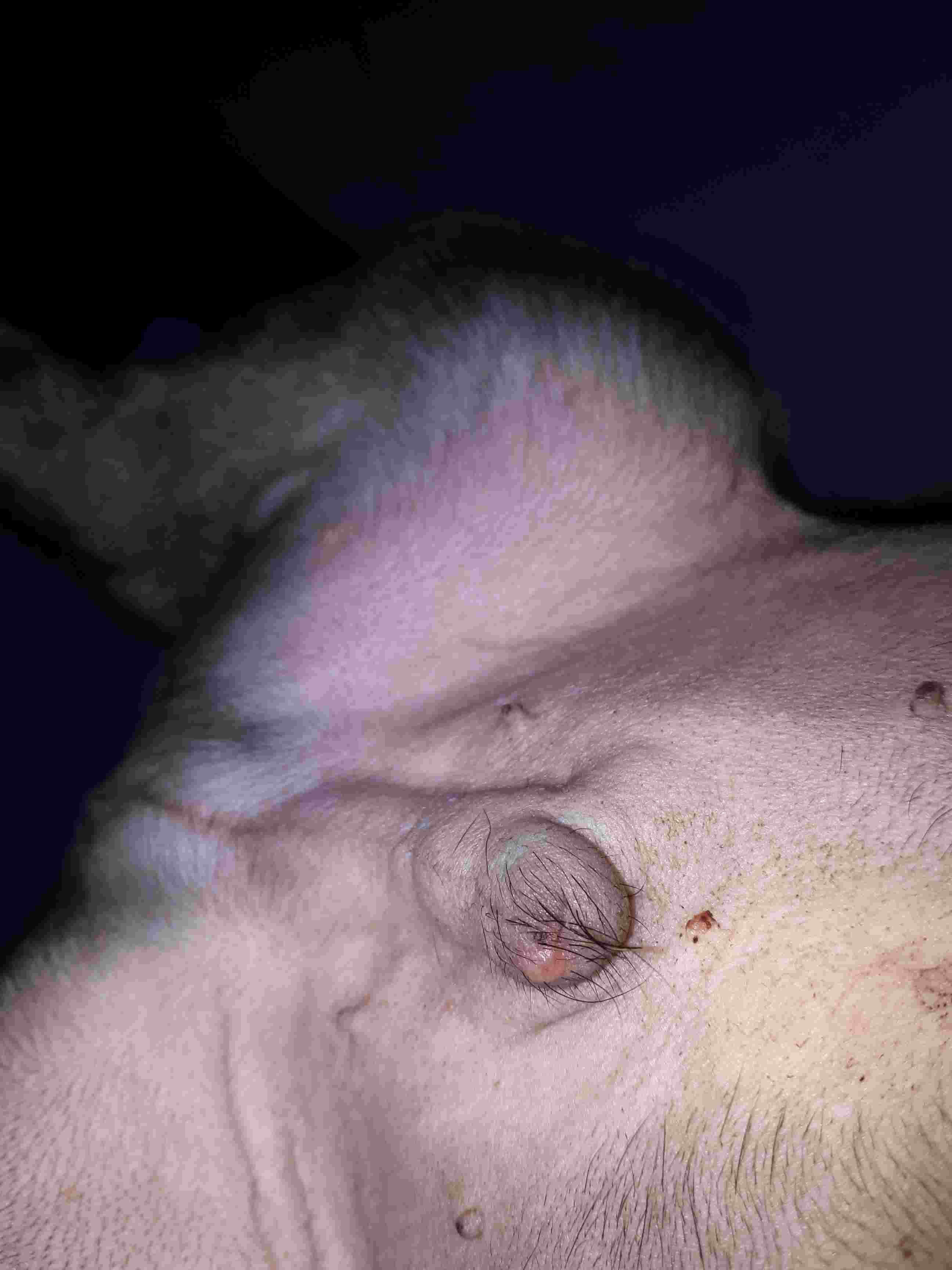 Question details sensitive content