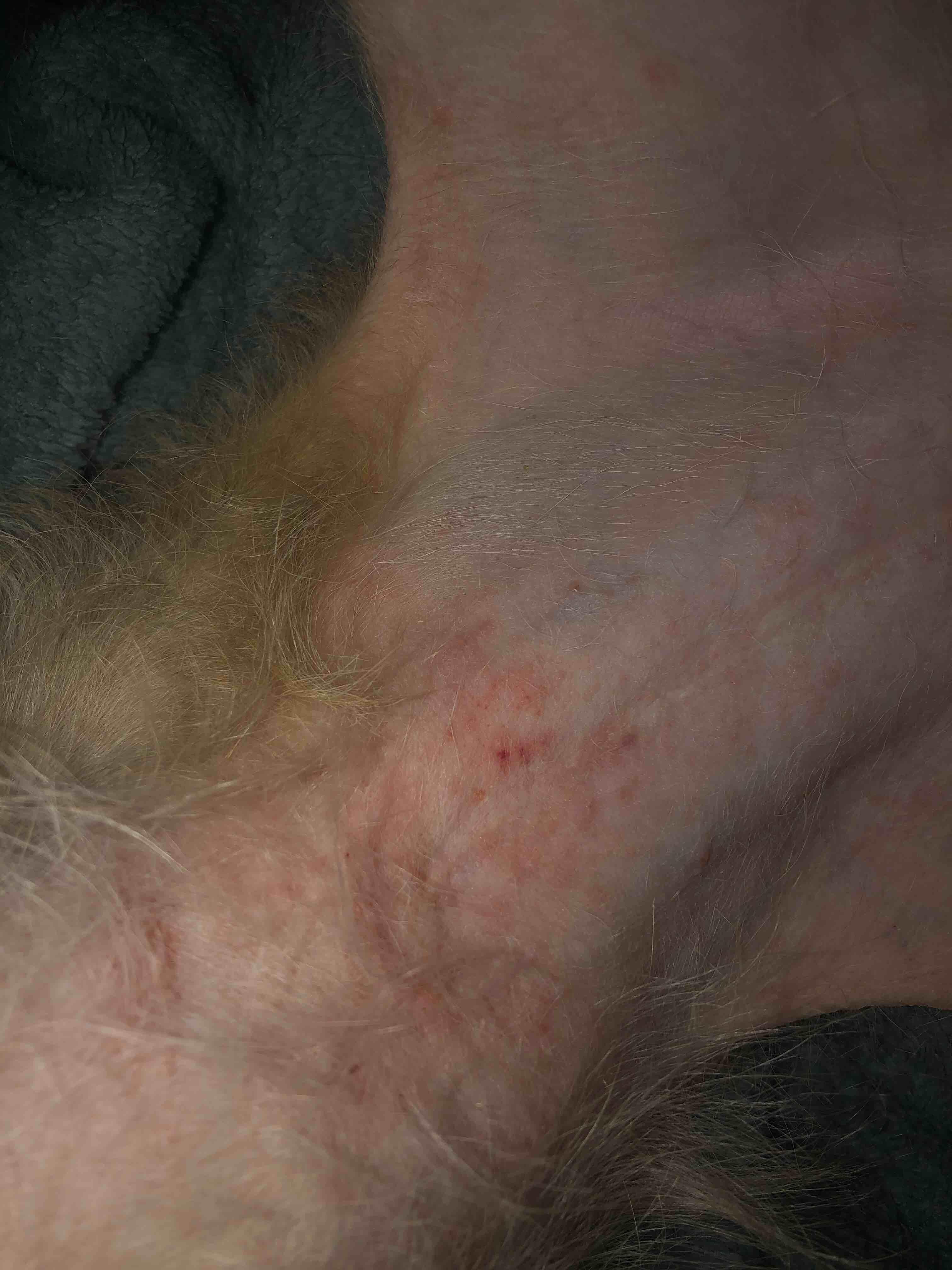 Question details sensitive content