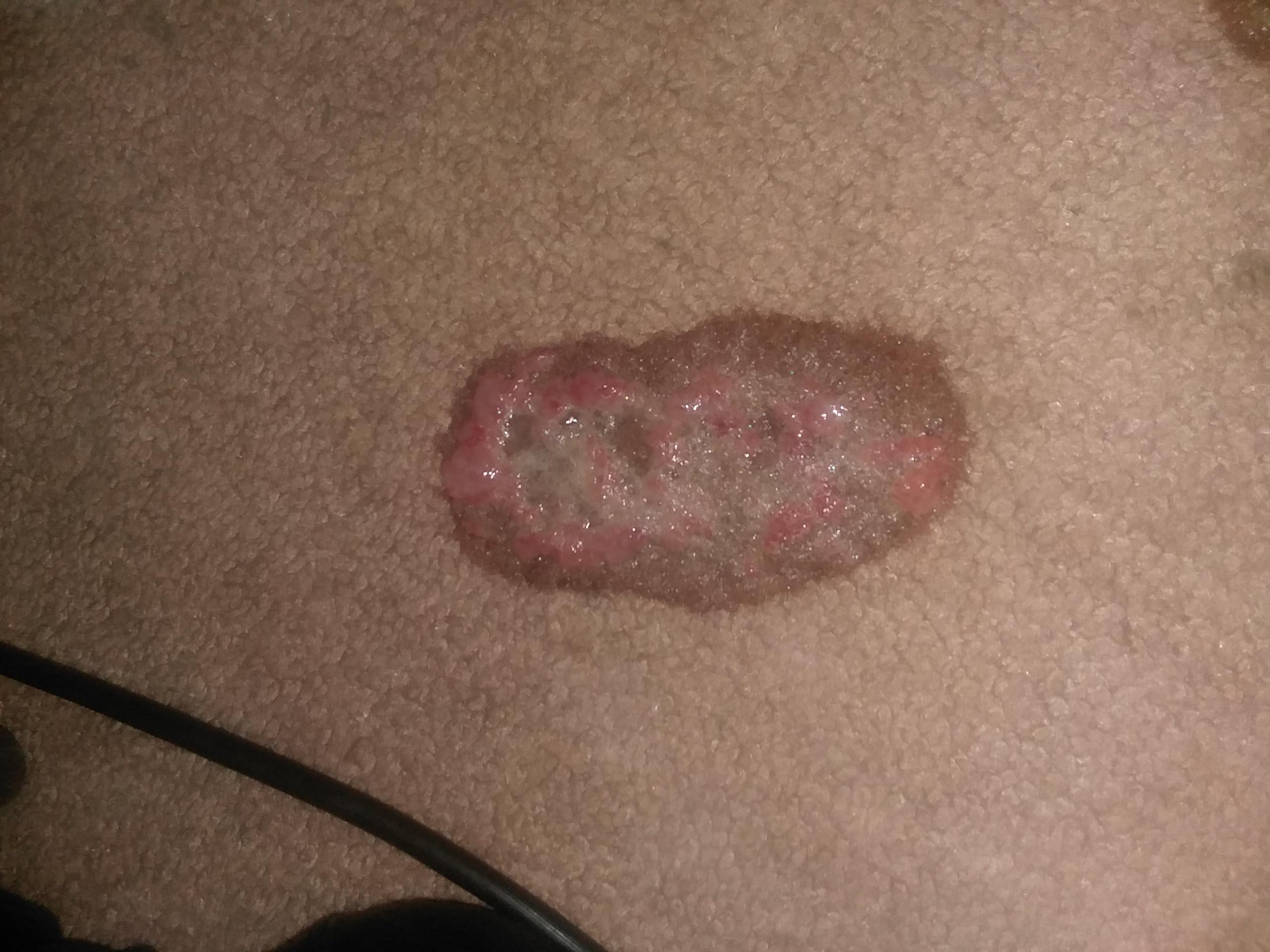 Question details sensitive content