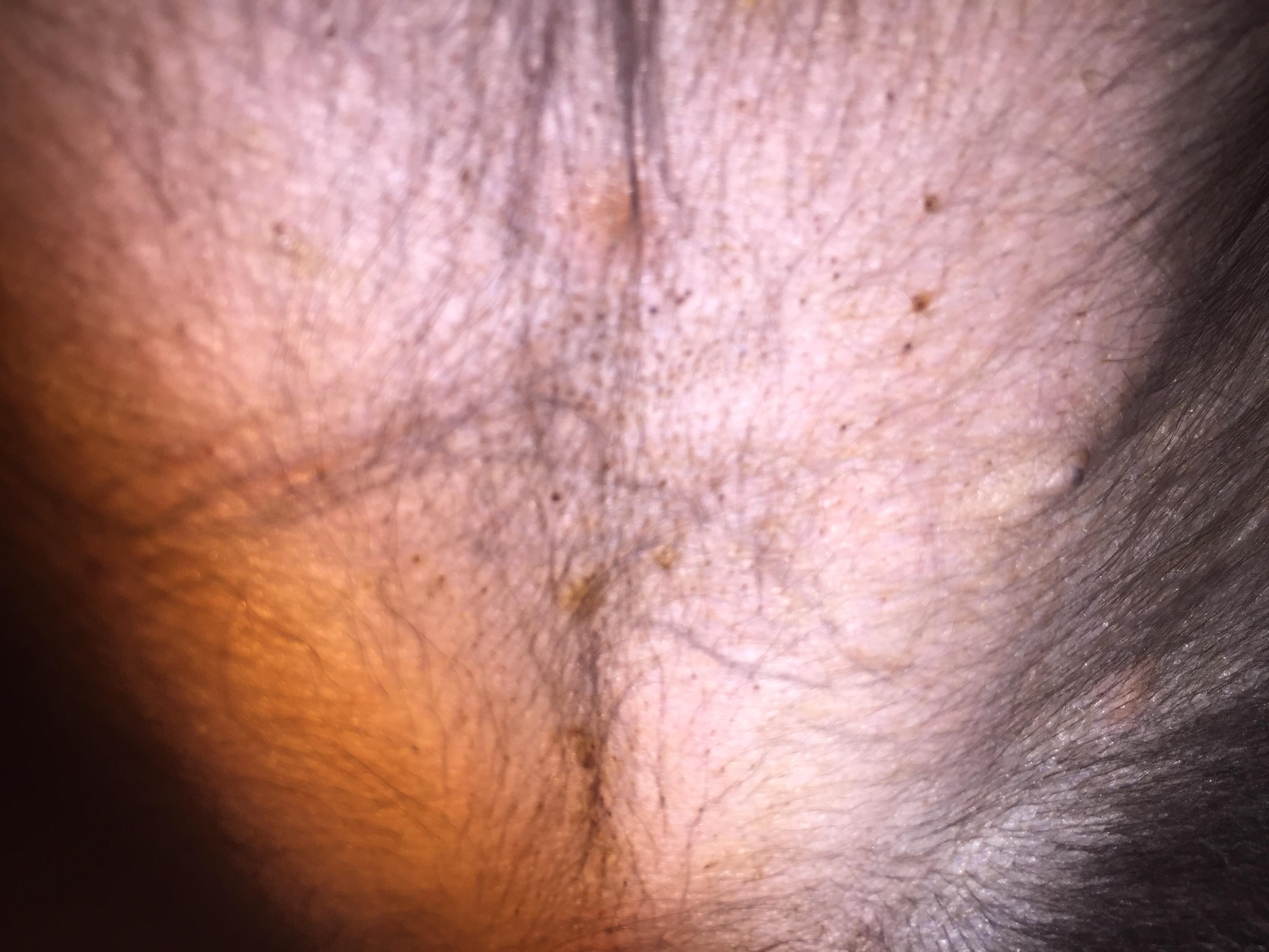 Question details sensitive content