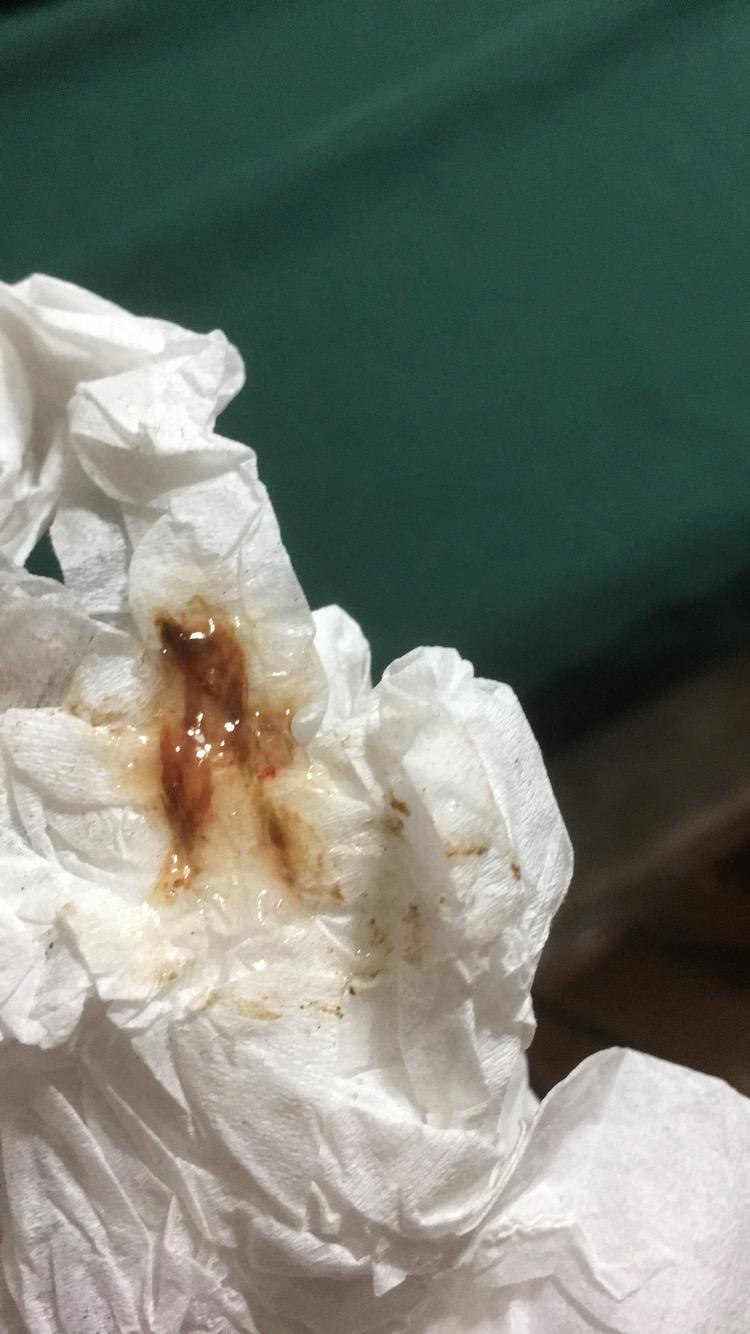 Question details sensitive content