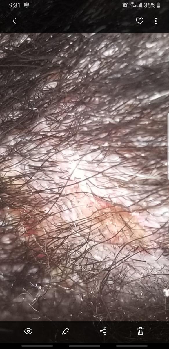 Question details sensitive content