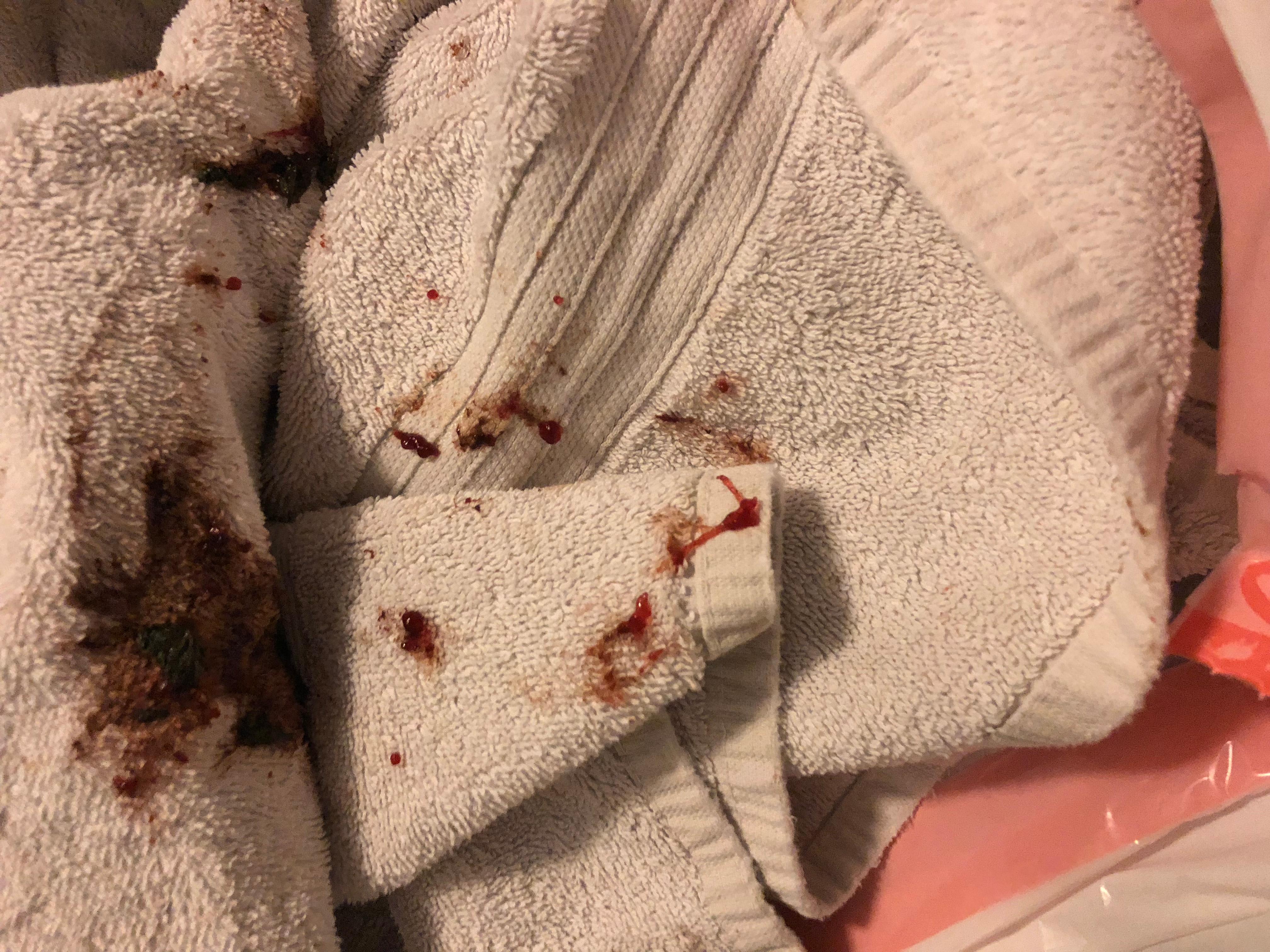 Question details sensitive content