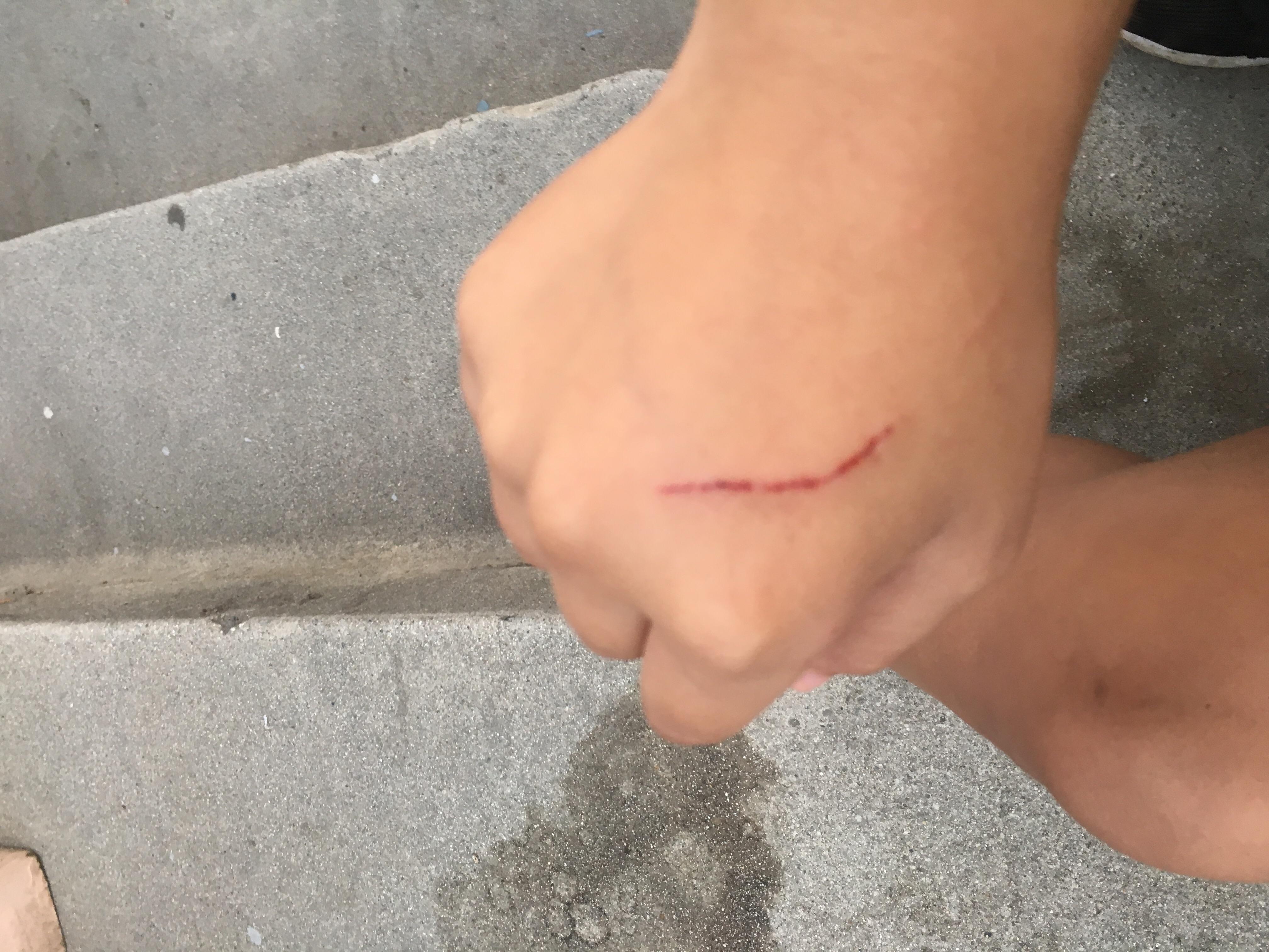 Question details sensitive content