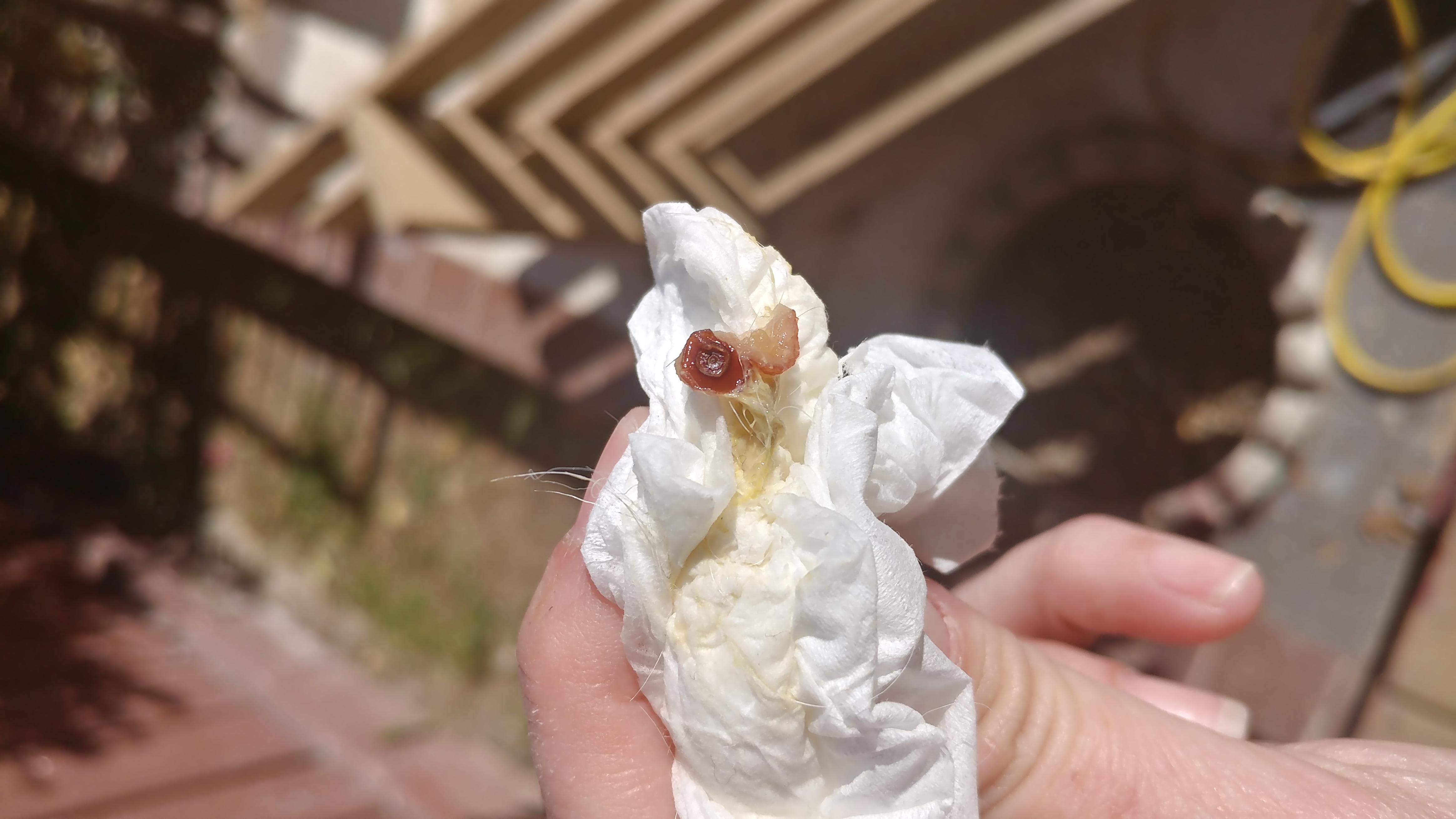 Question details sensitive content