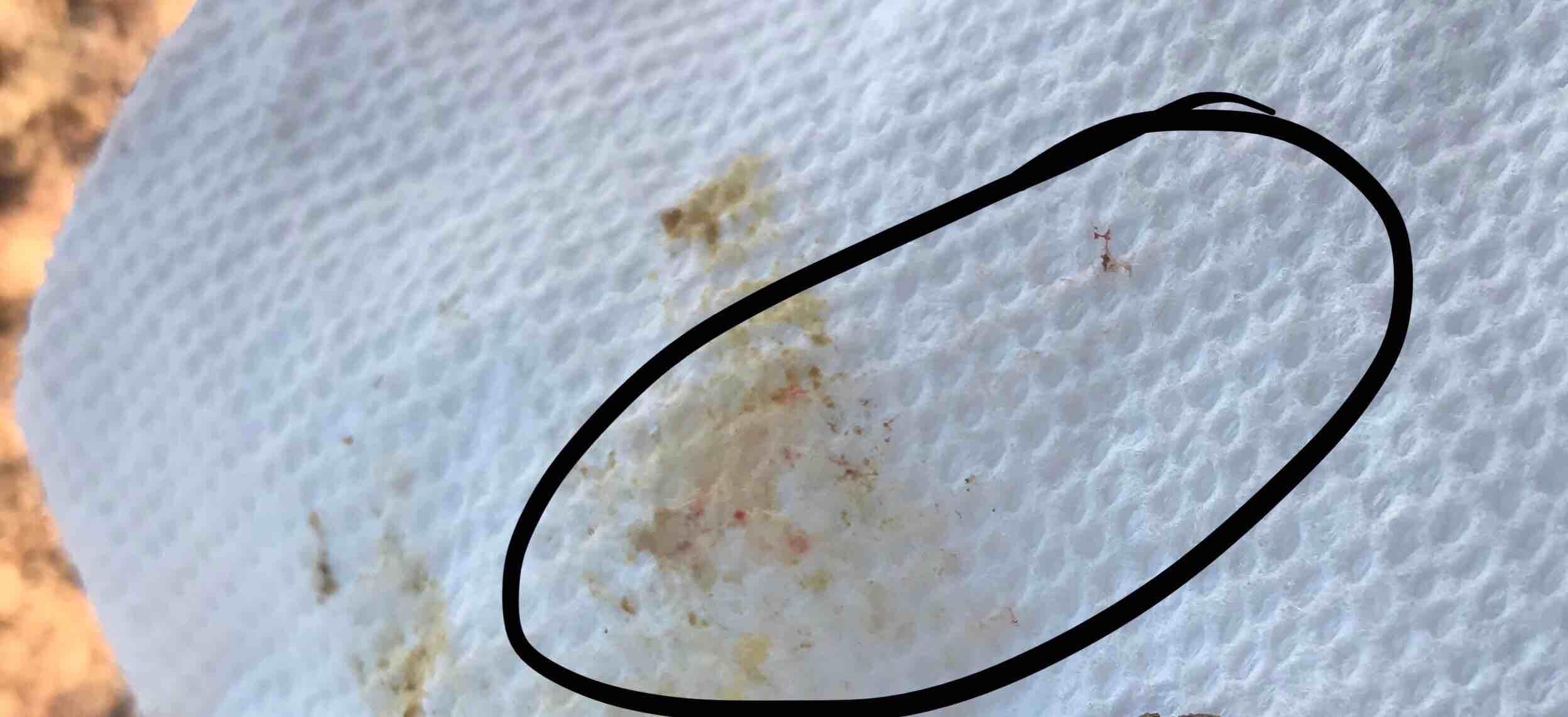 Question details sensitive content