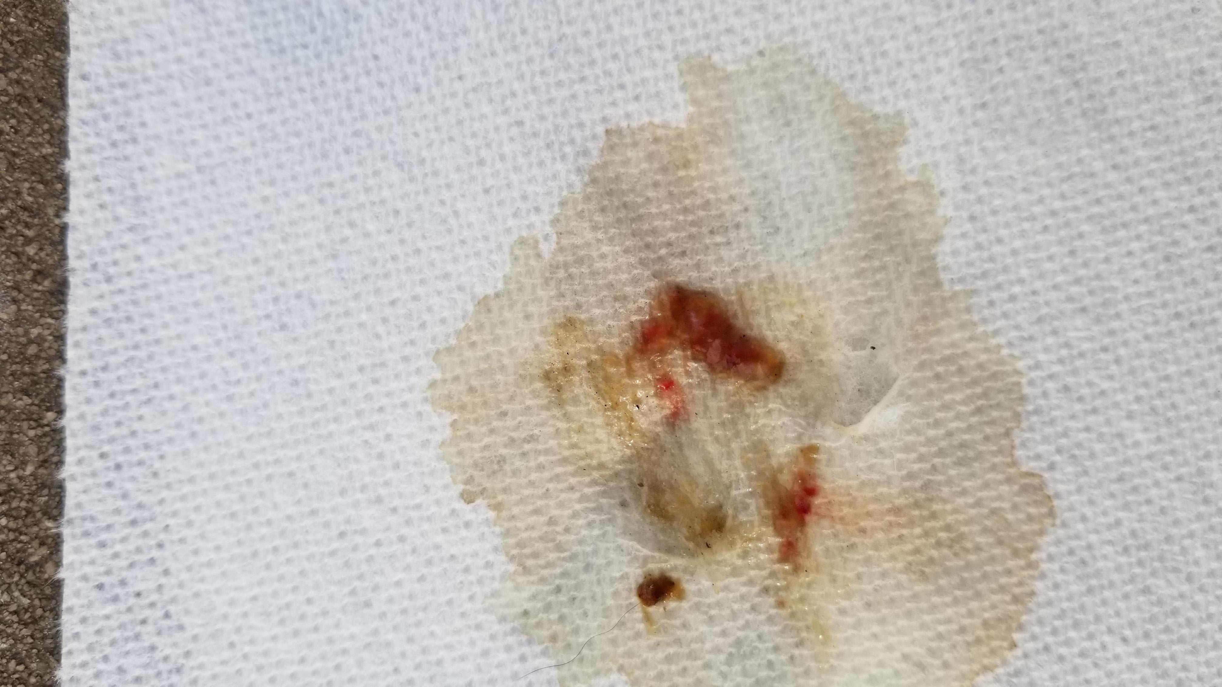 Question details sensitive content