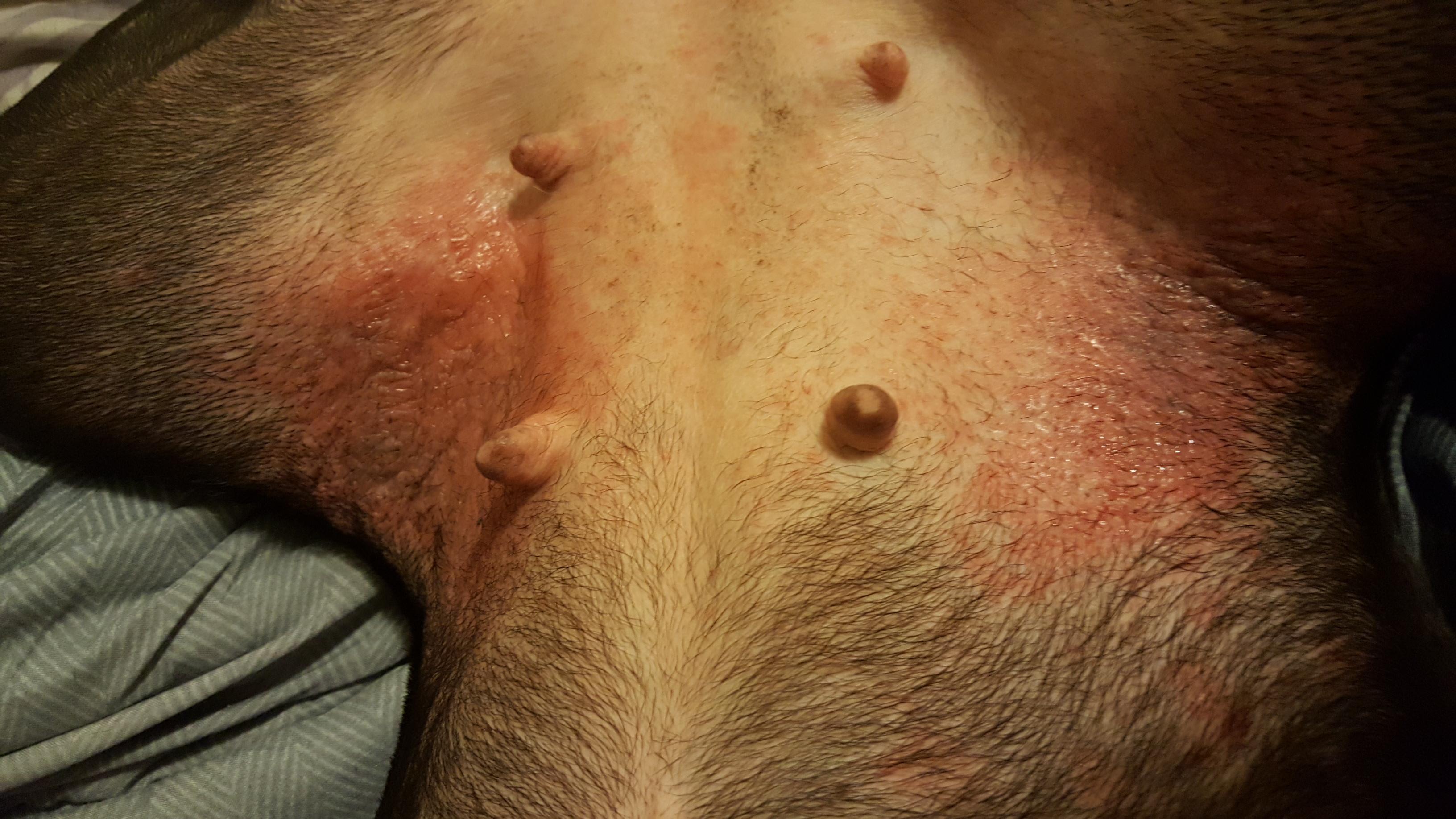 Question details sensitive content