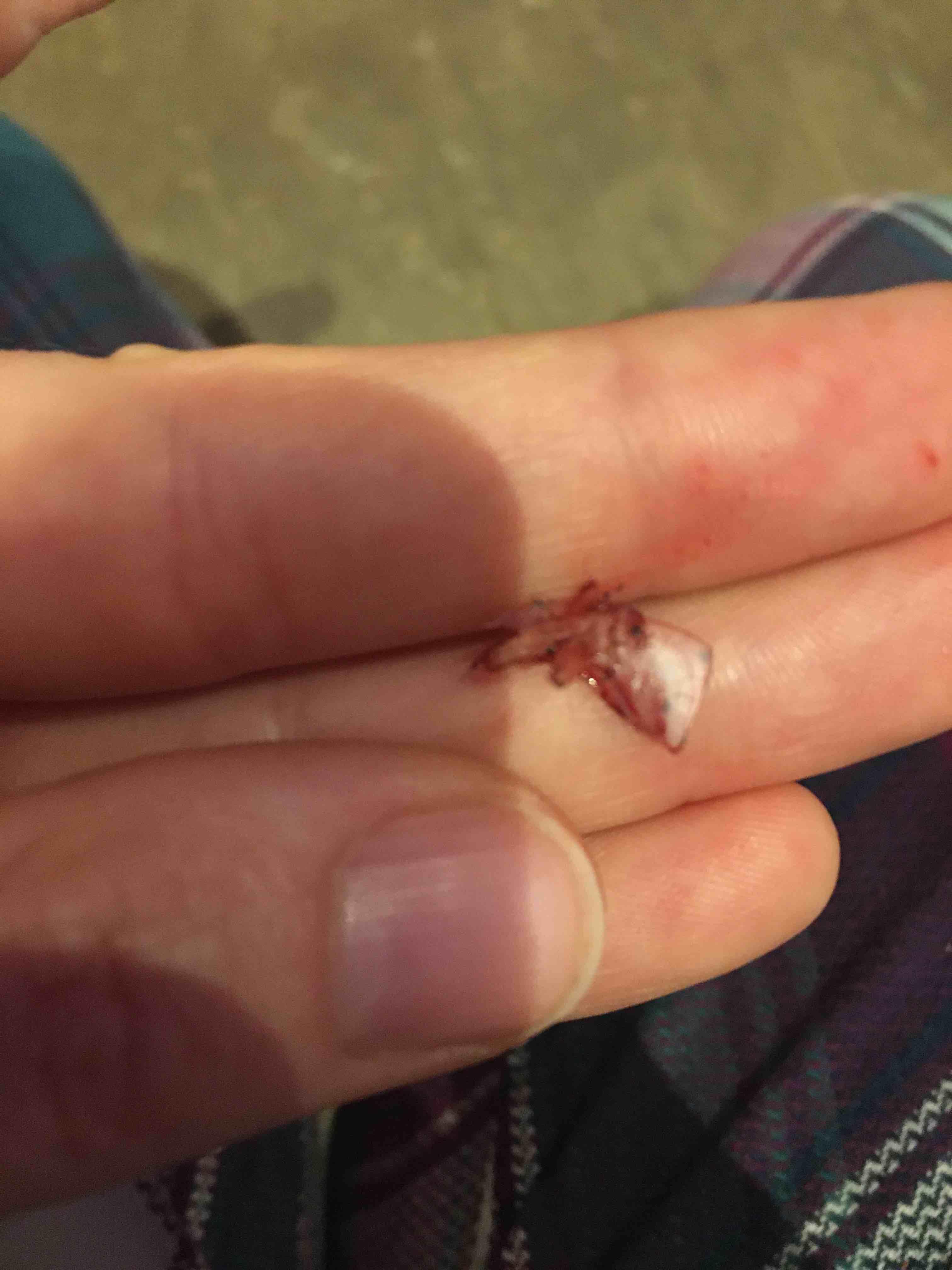 Question details sensitive content