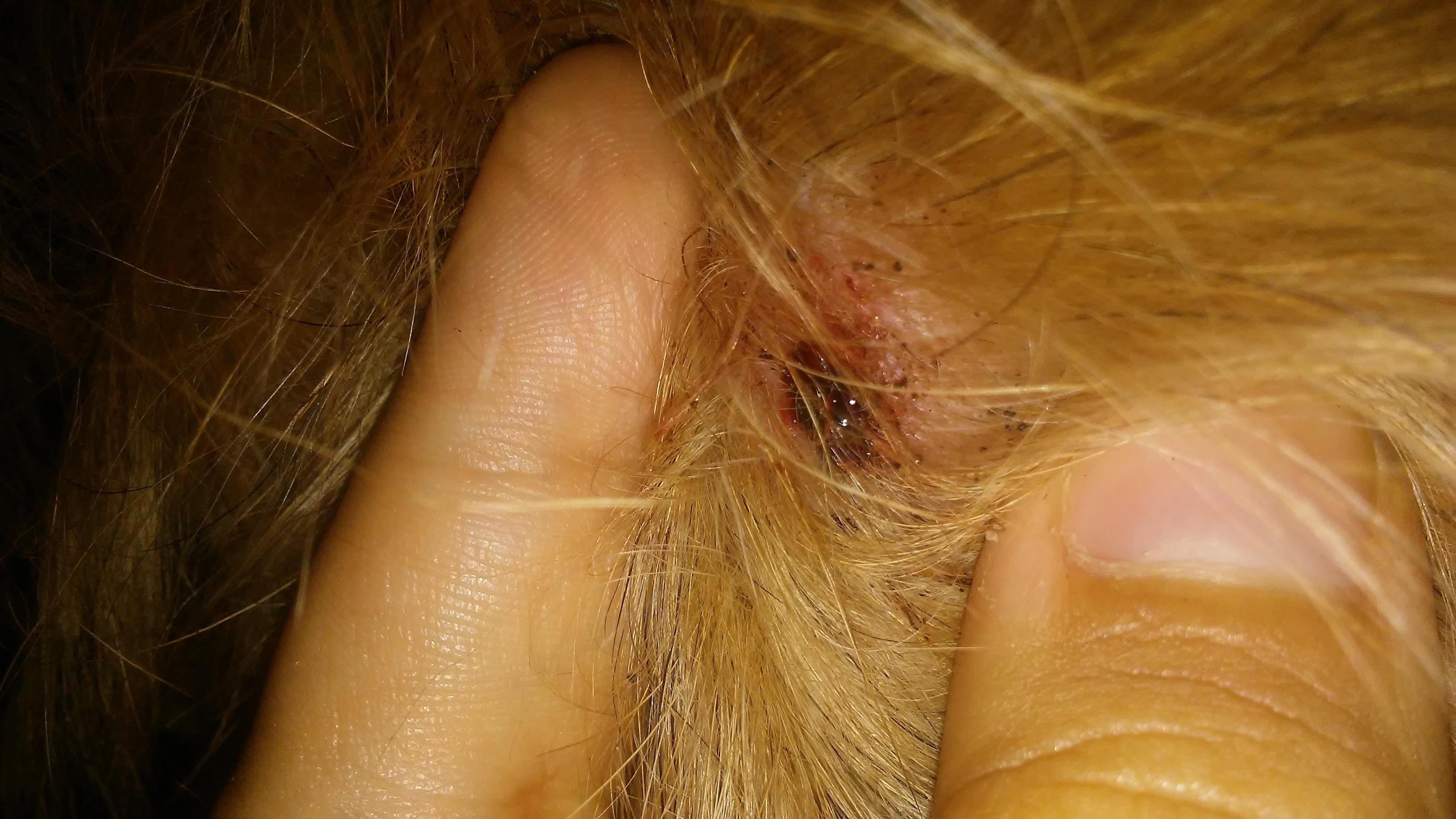 Question details sensitive content