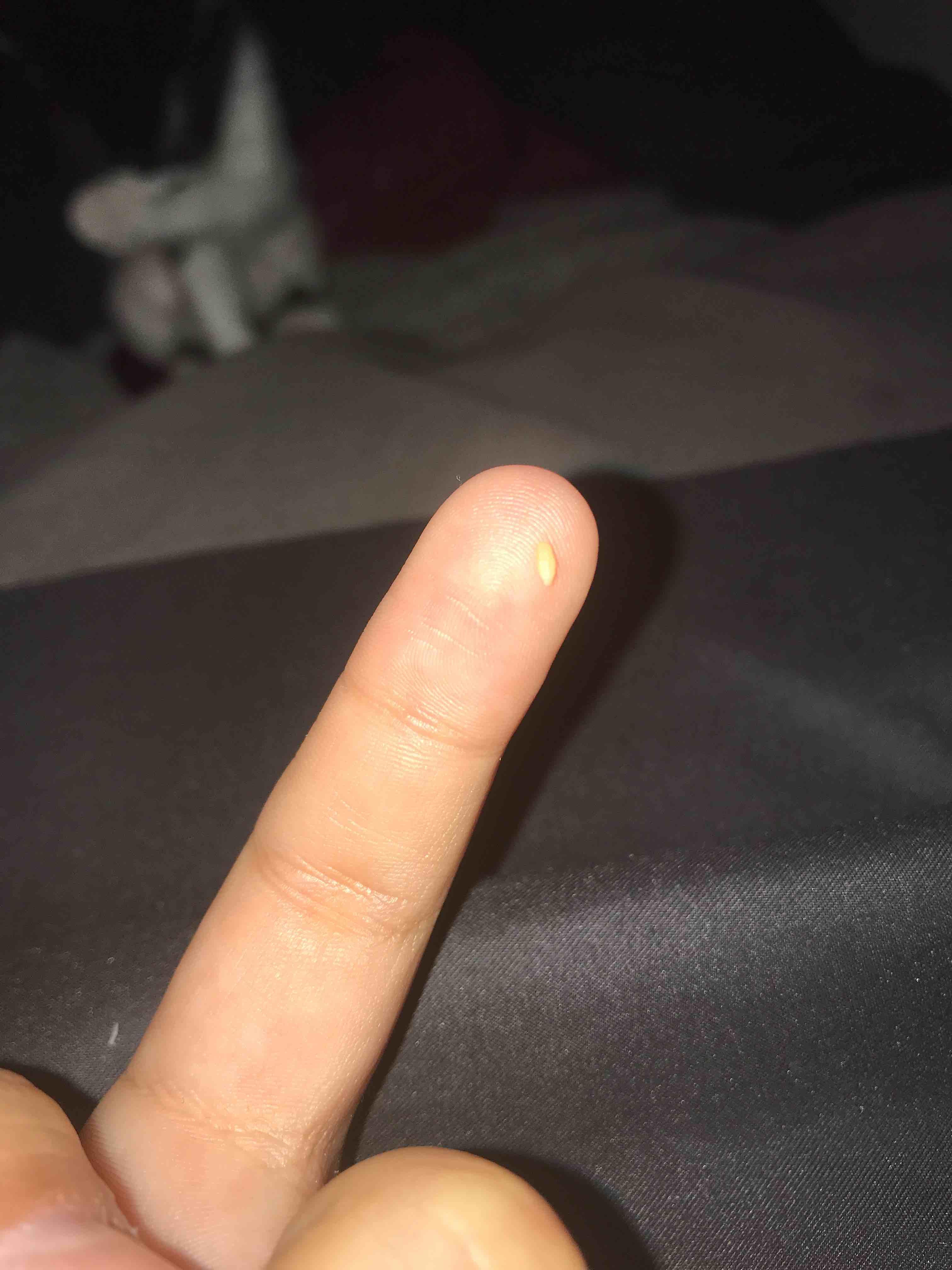 Question details sensitive content