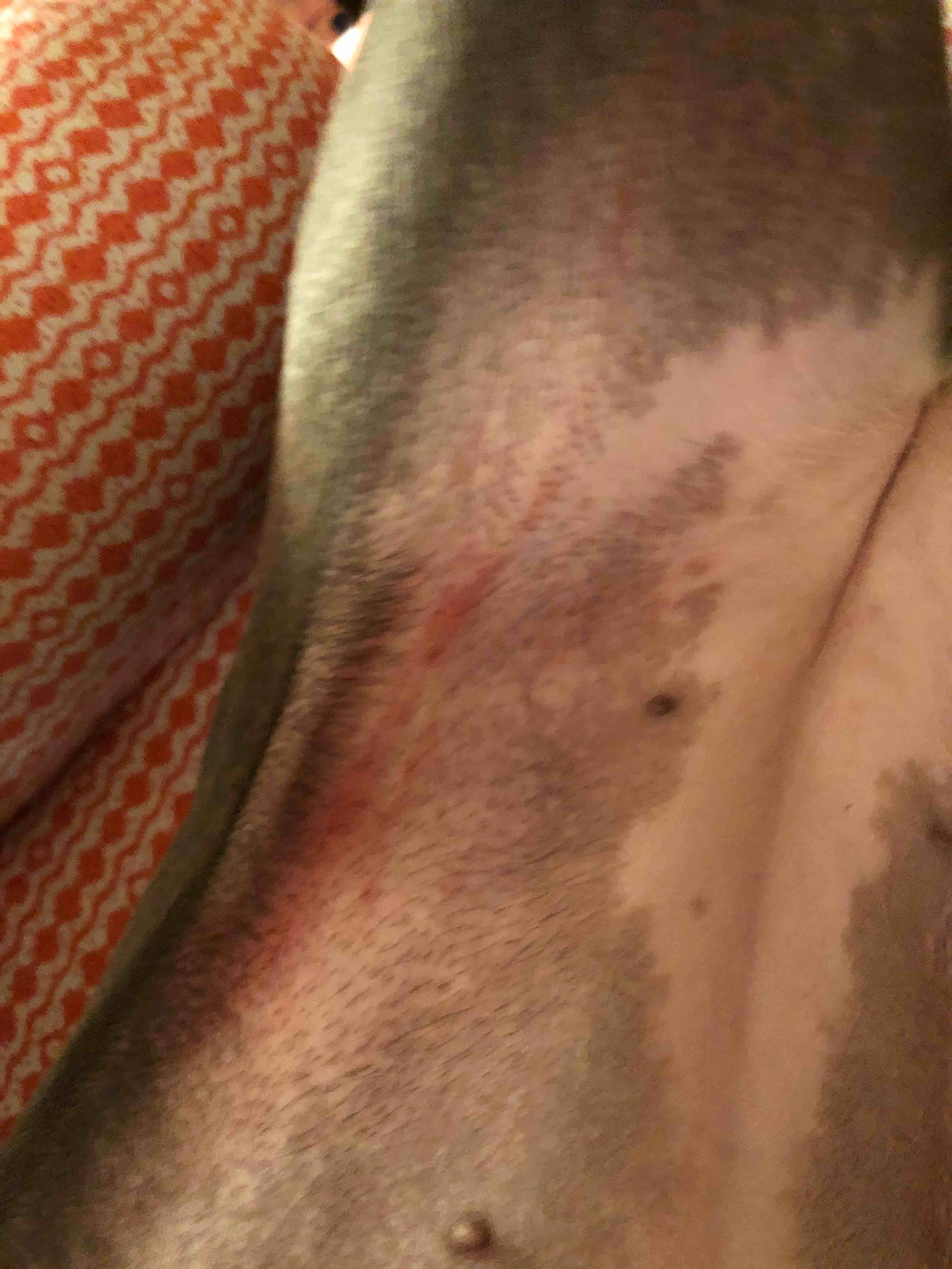 Question details sensitive content