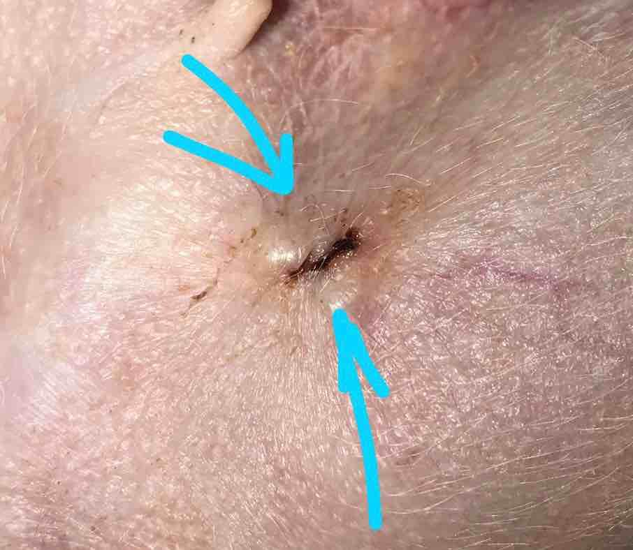 Question details sensitive content