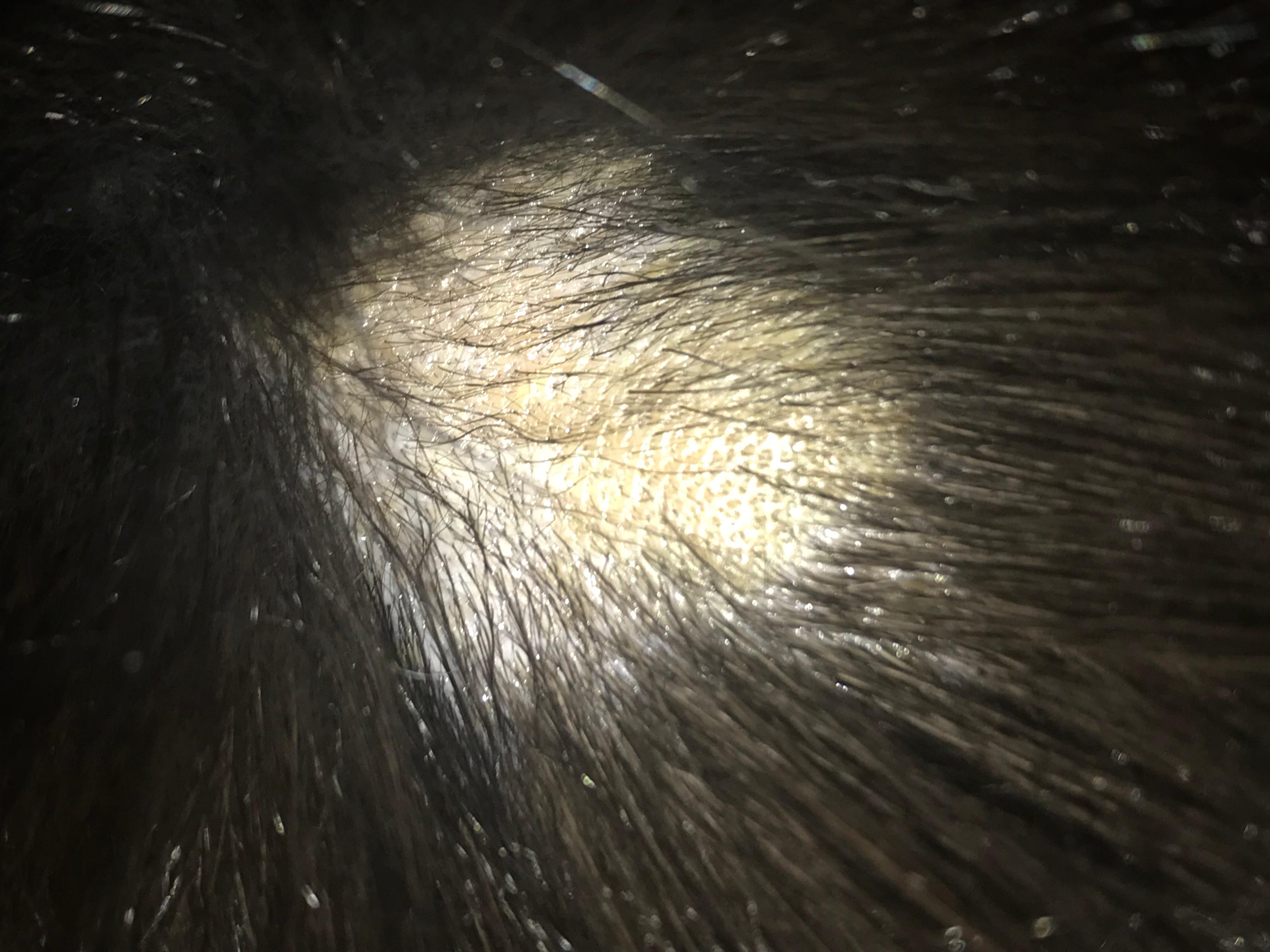 Question details sensitive content