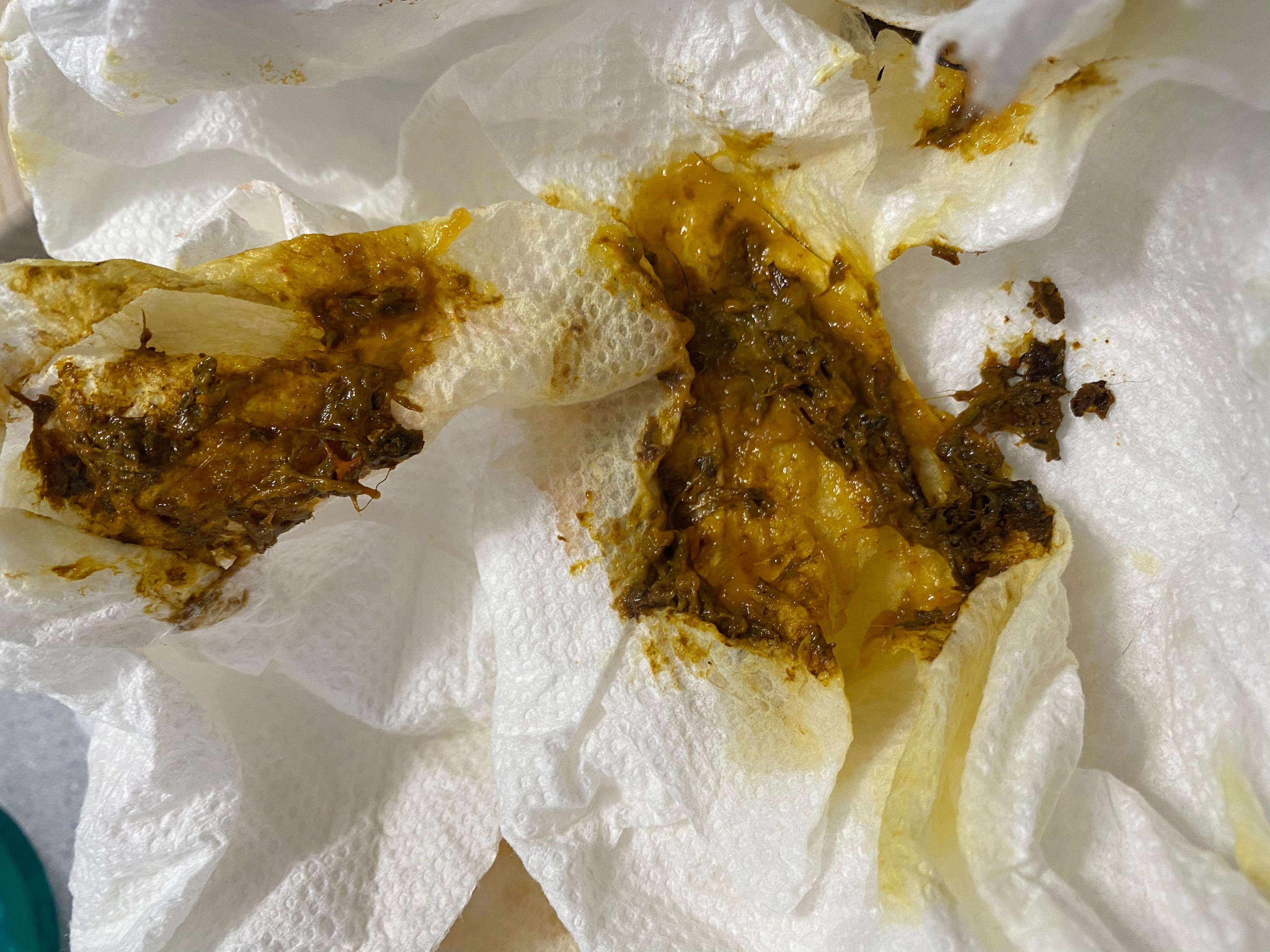 Question details sensitive content