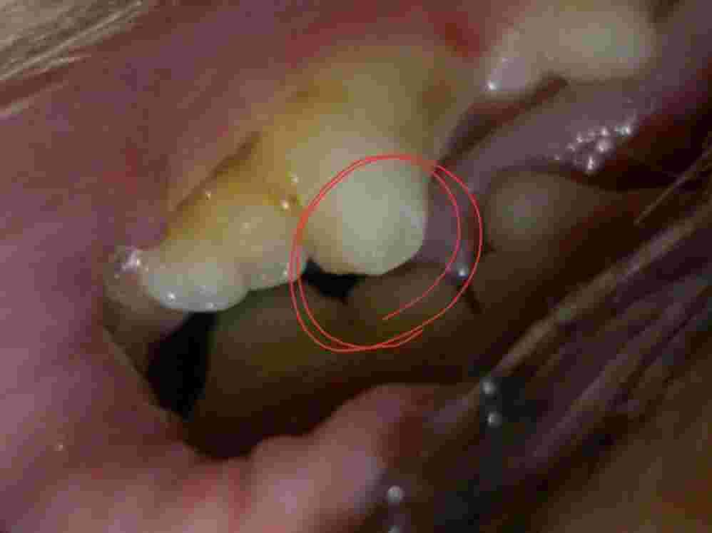 Question details sensitive content