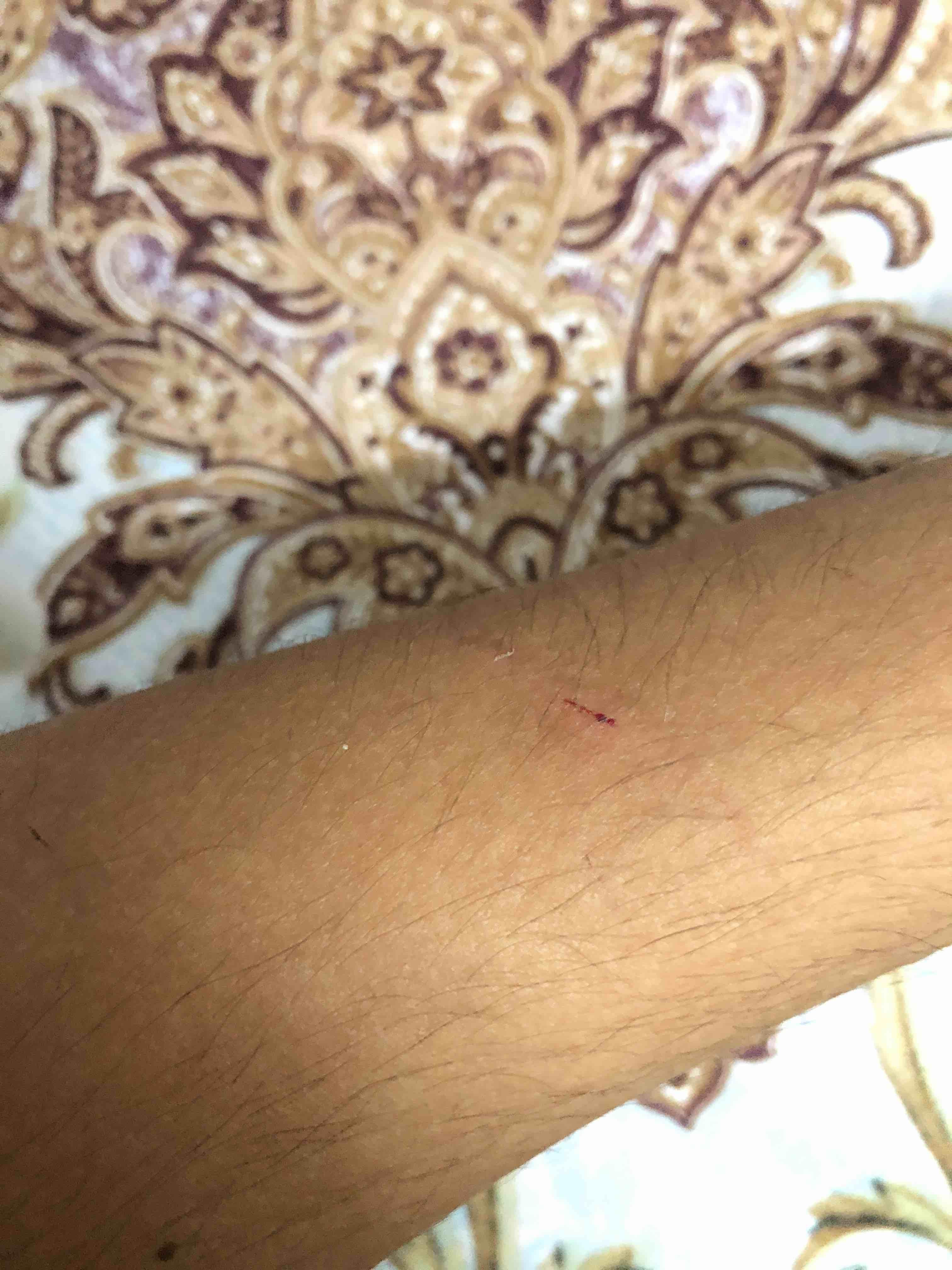 Question details sensitive content