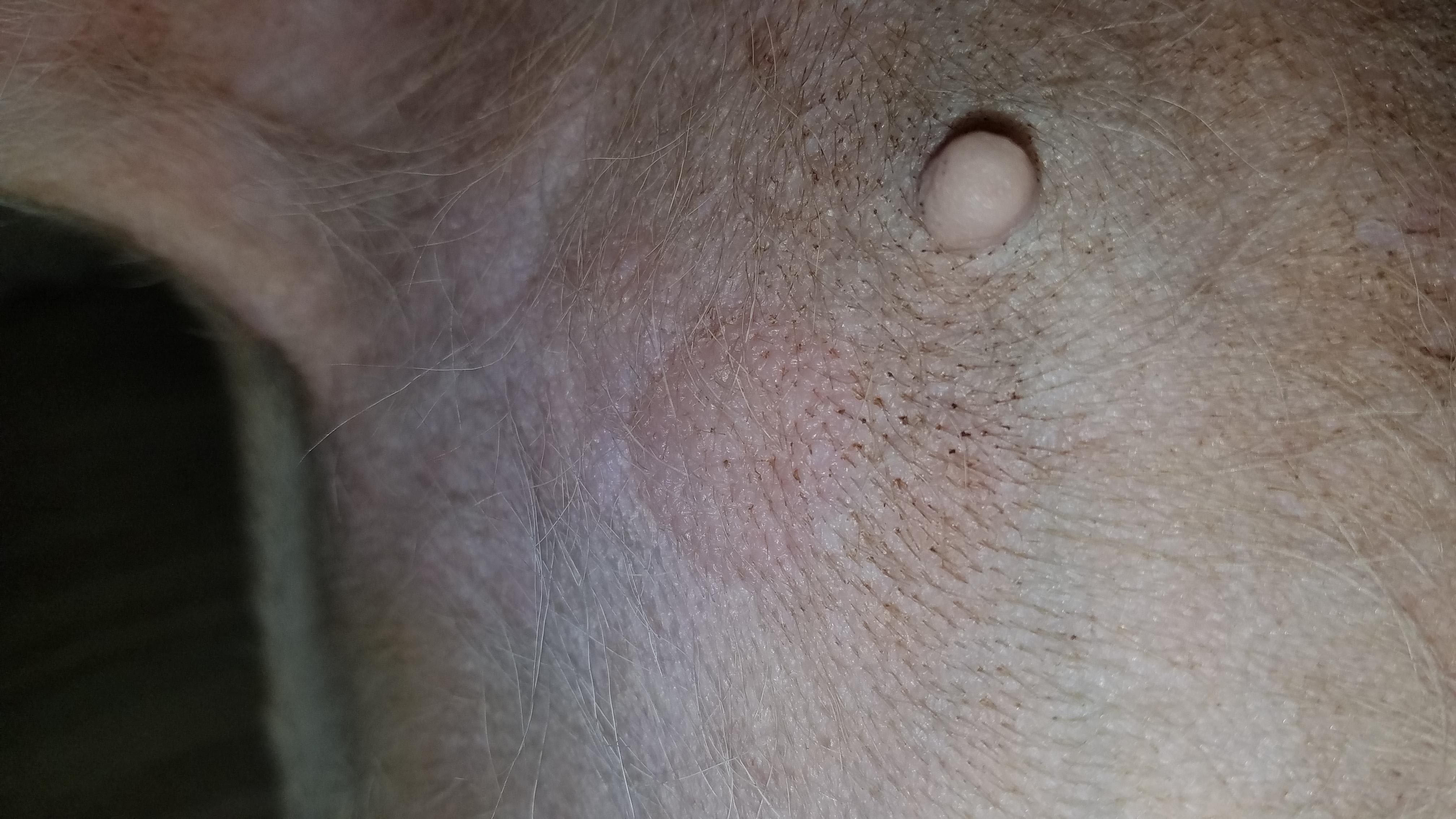 Question details sensitive content