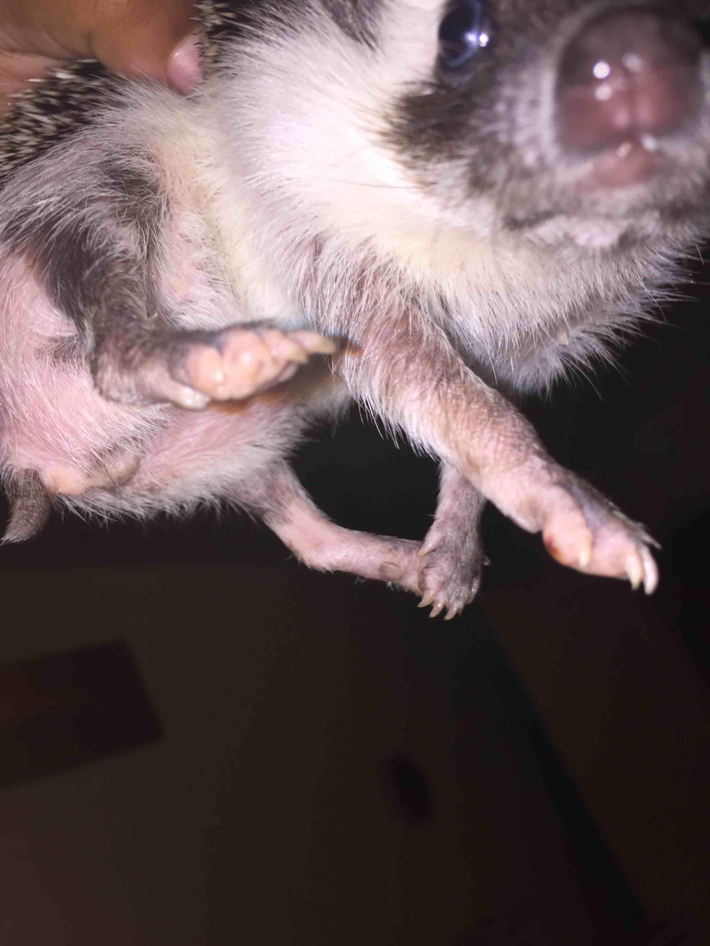 Question details sensitive content