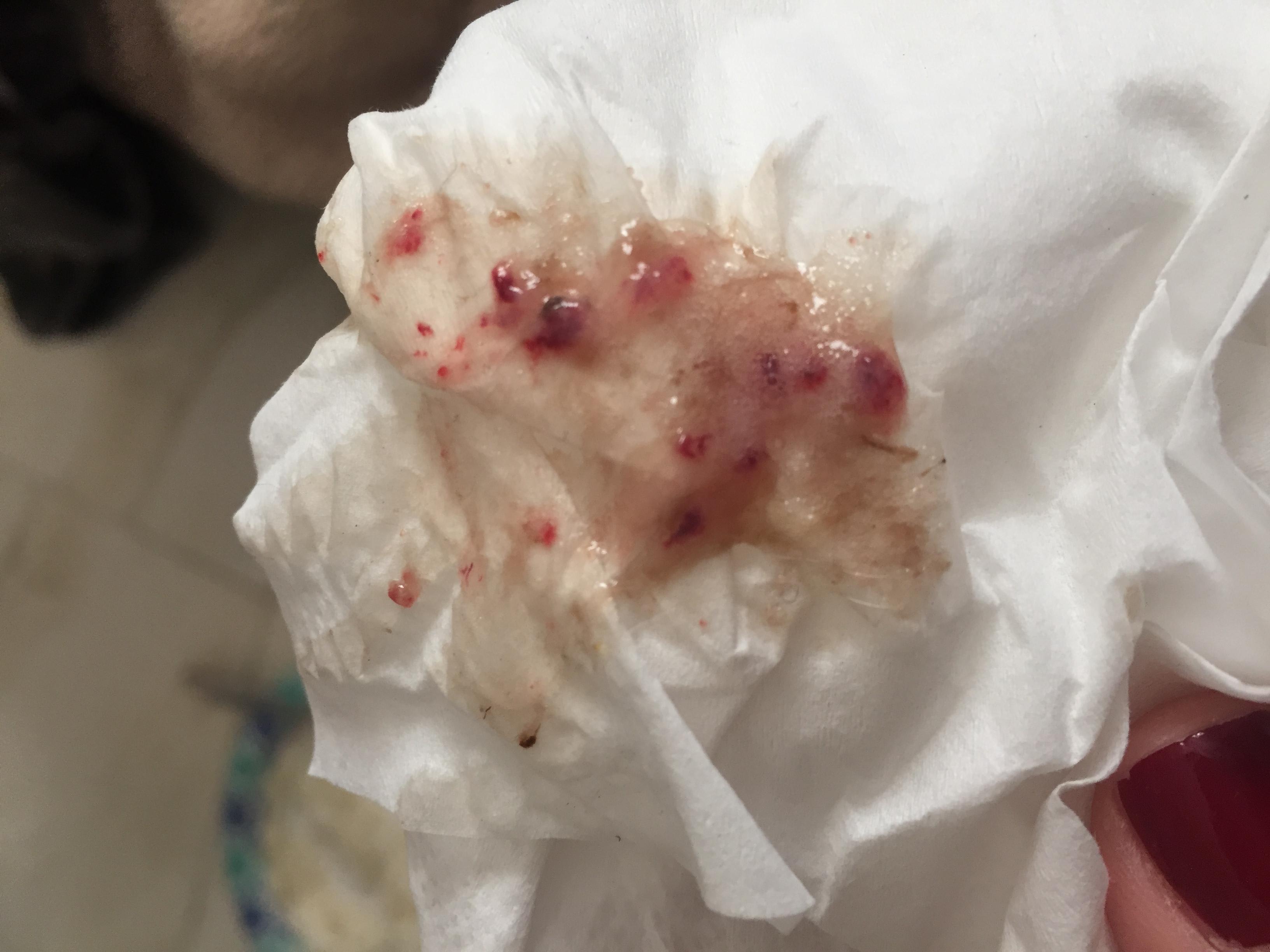 Question details sensitive content