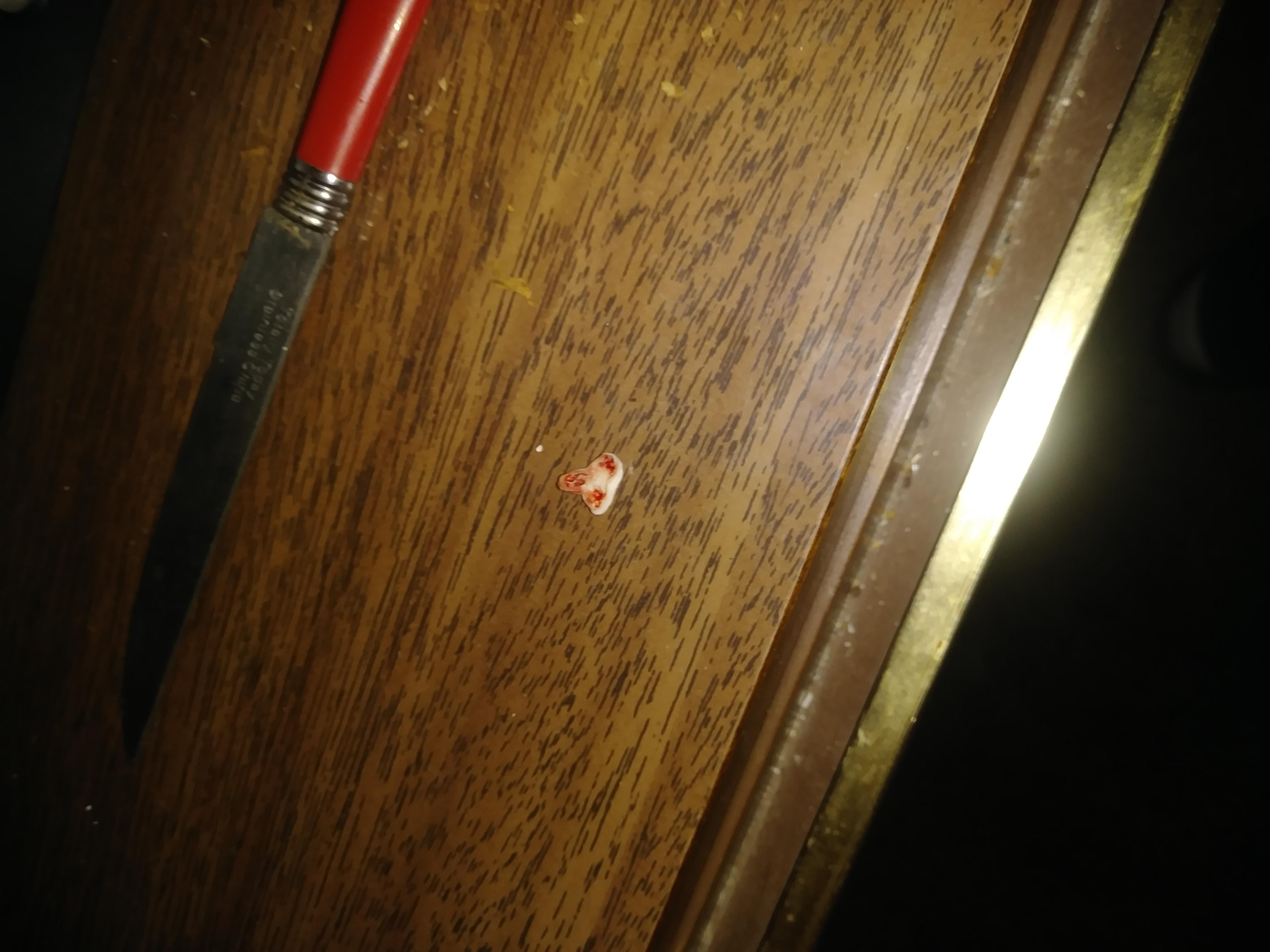 Question details sensitive content