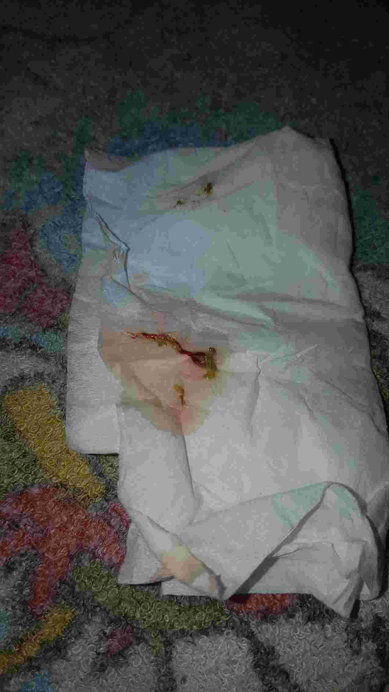 Question details sensitive content