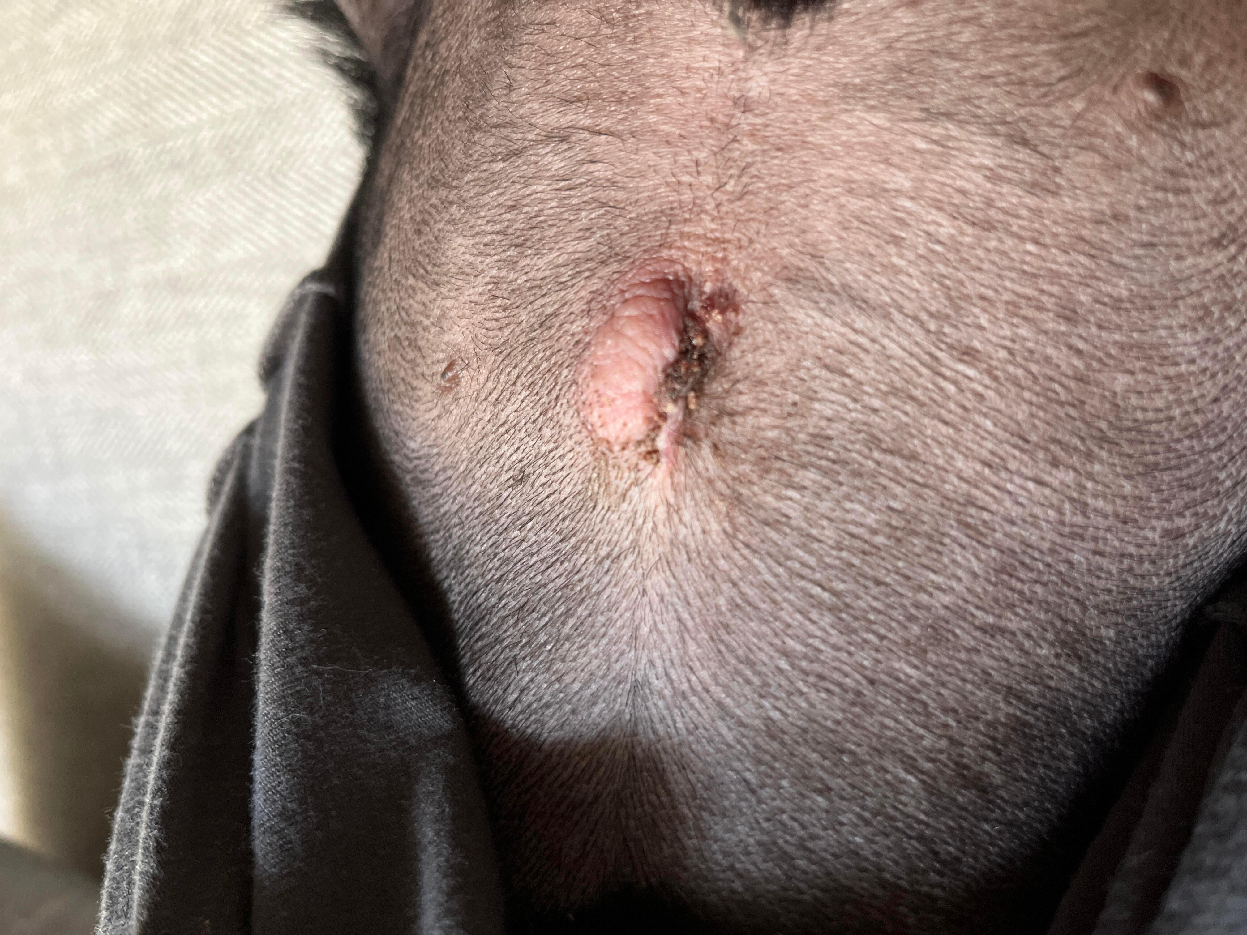 Question details sensitive content