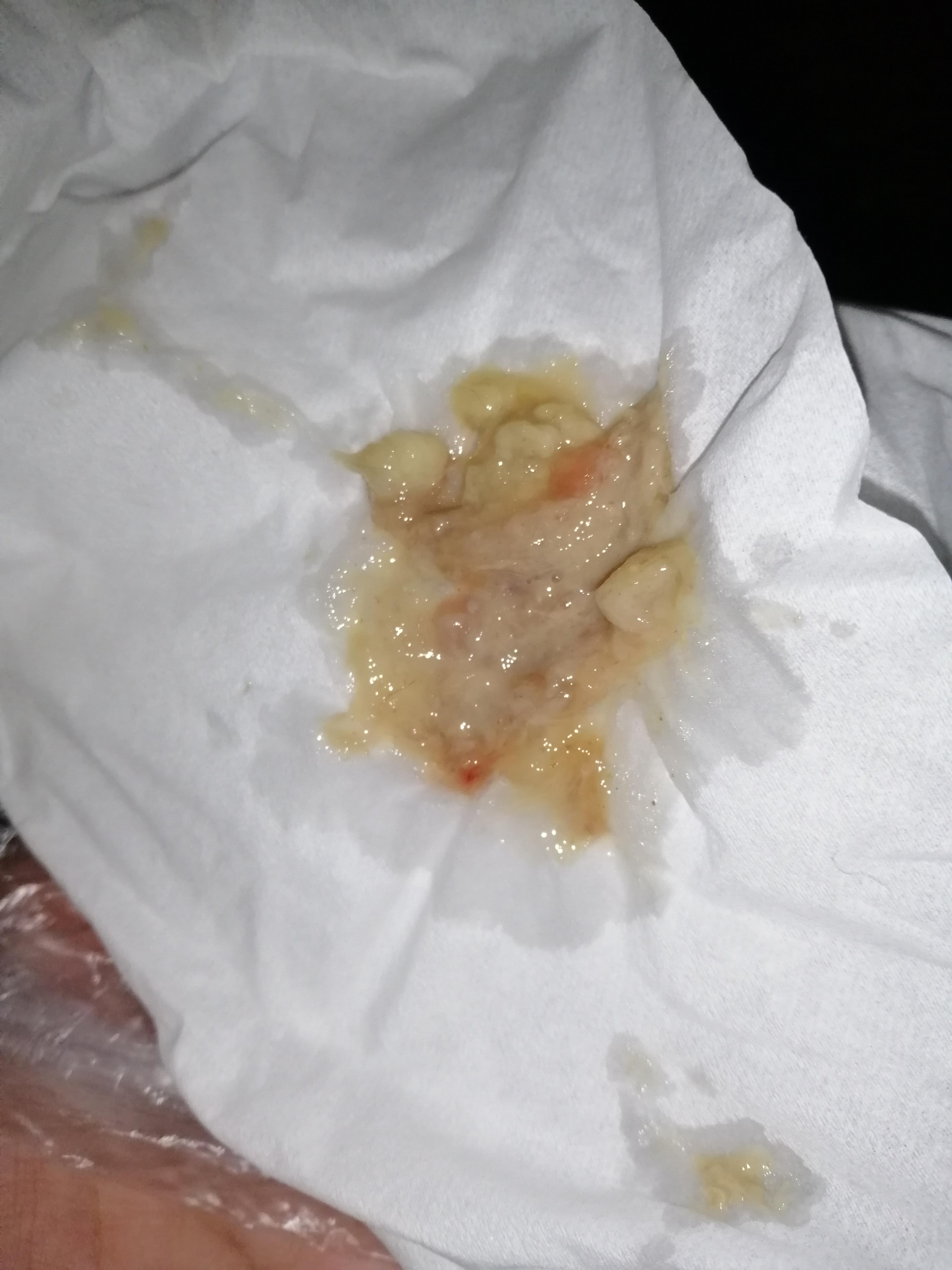 Question details sensitive content