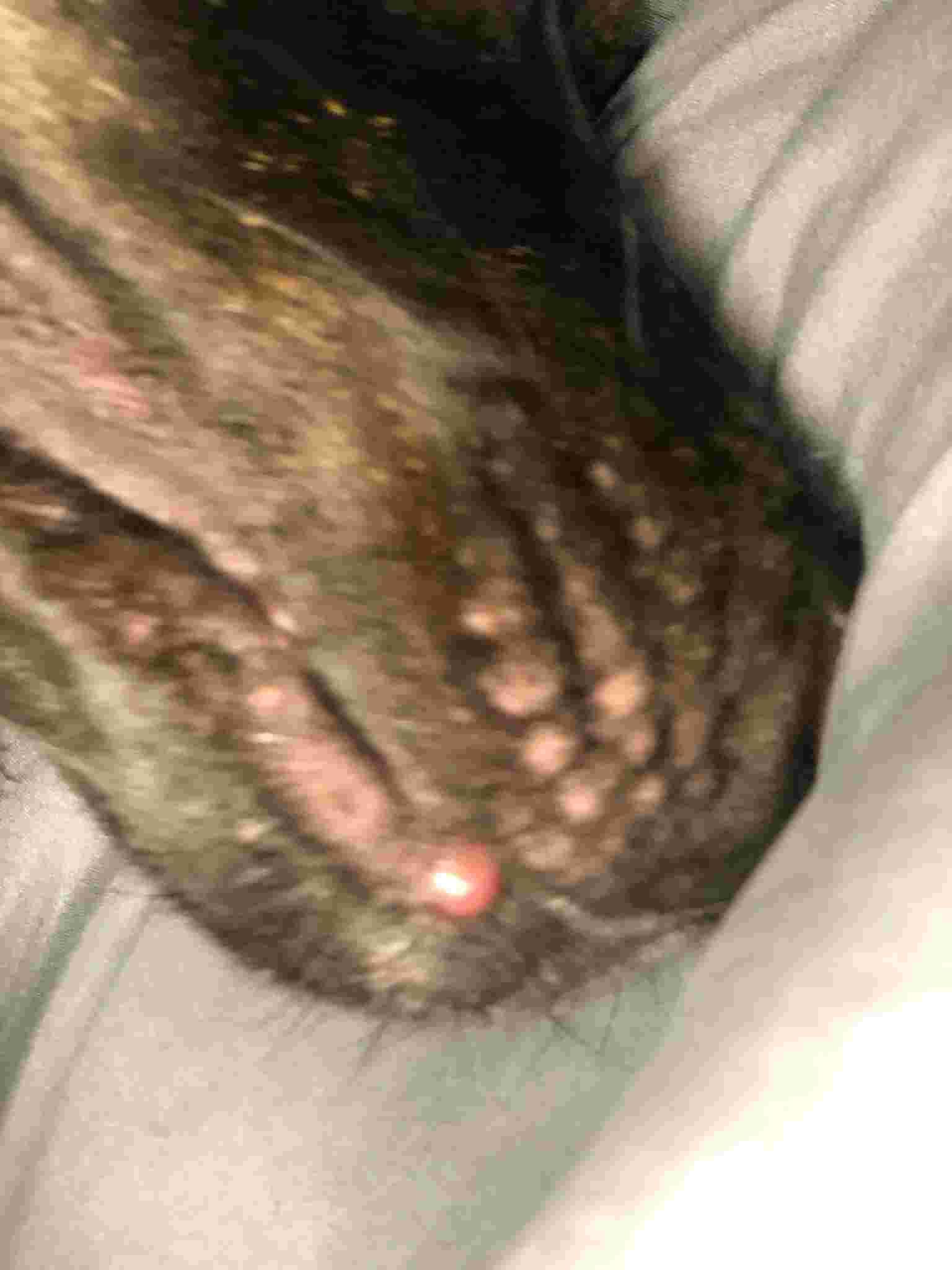 Question details sensitive content