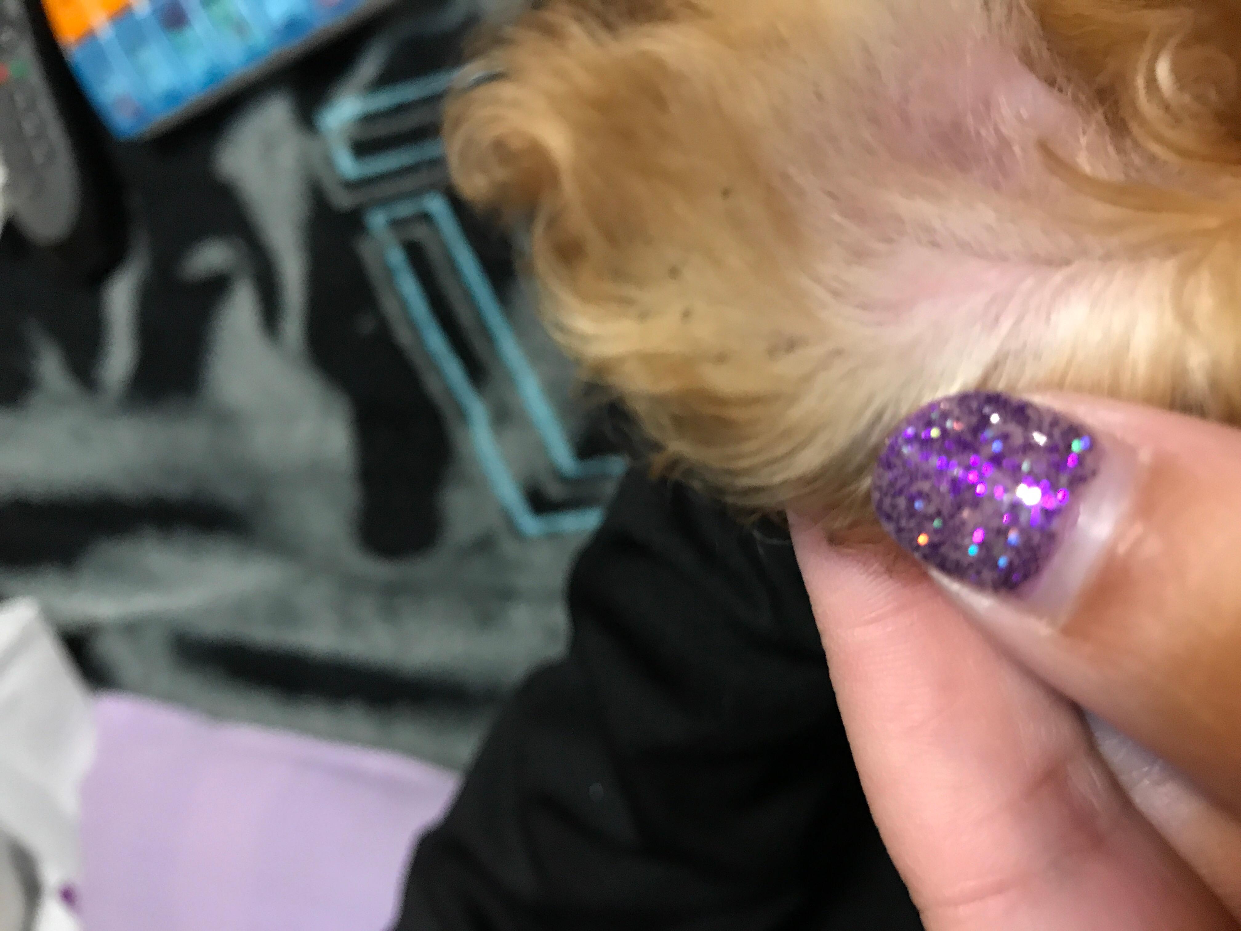 Question details sensitive content