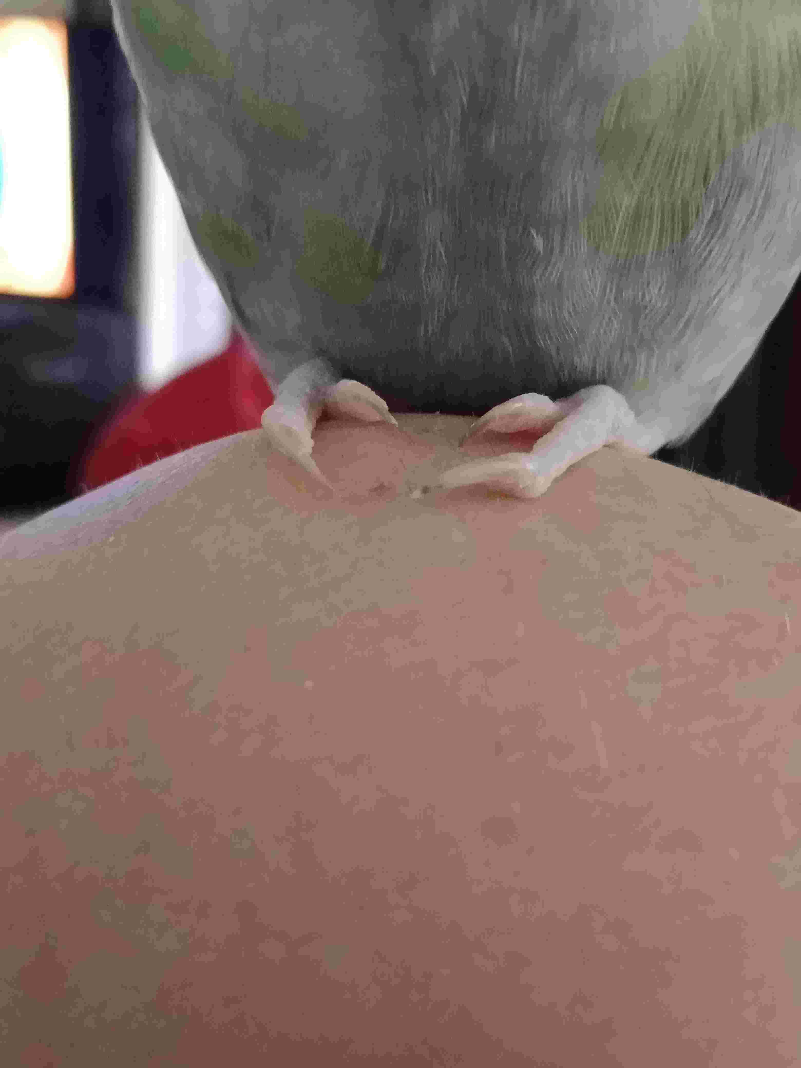 Question details sensitive content