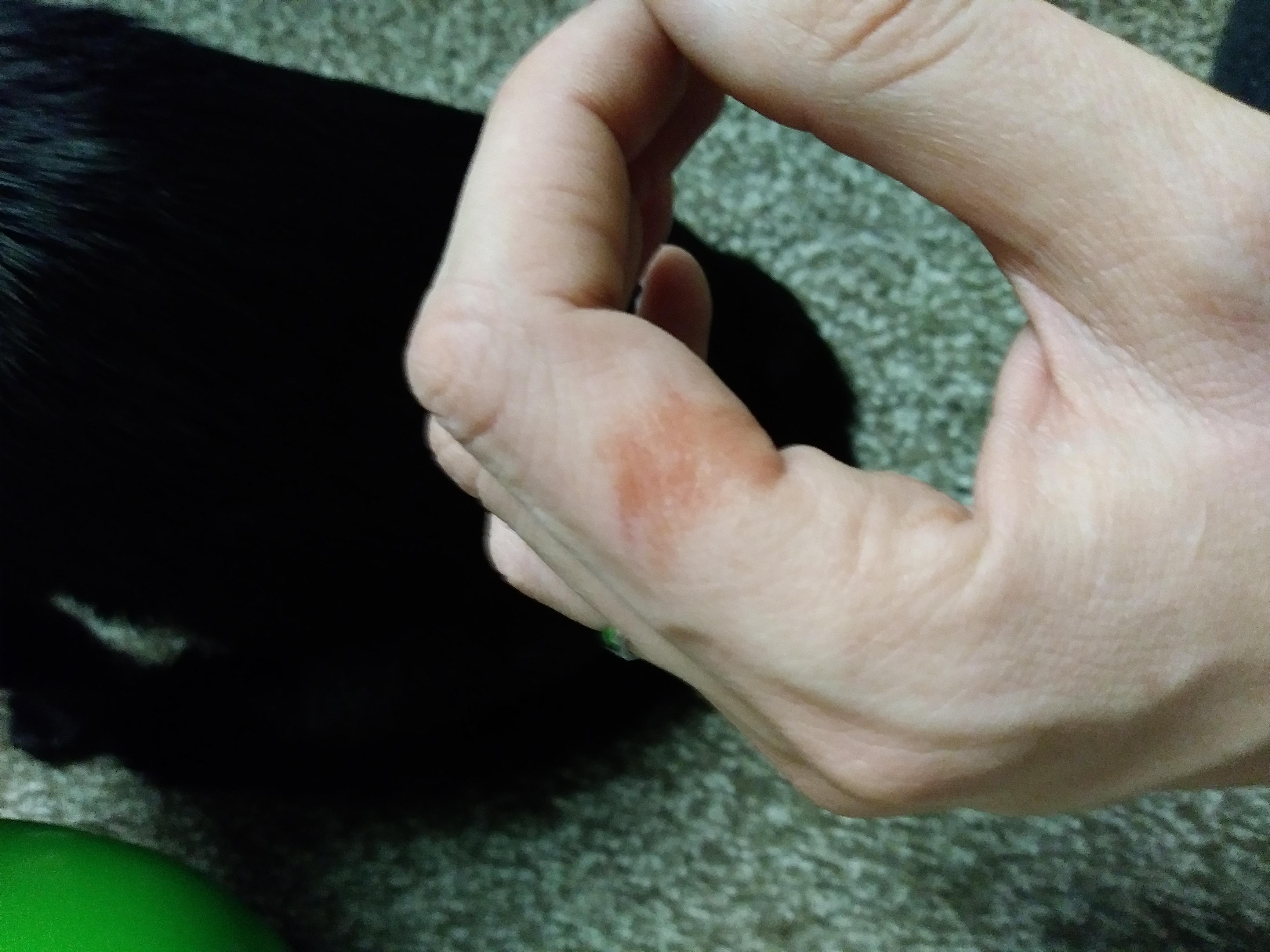 Question details sensitive content