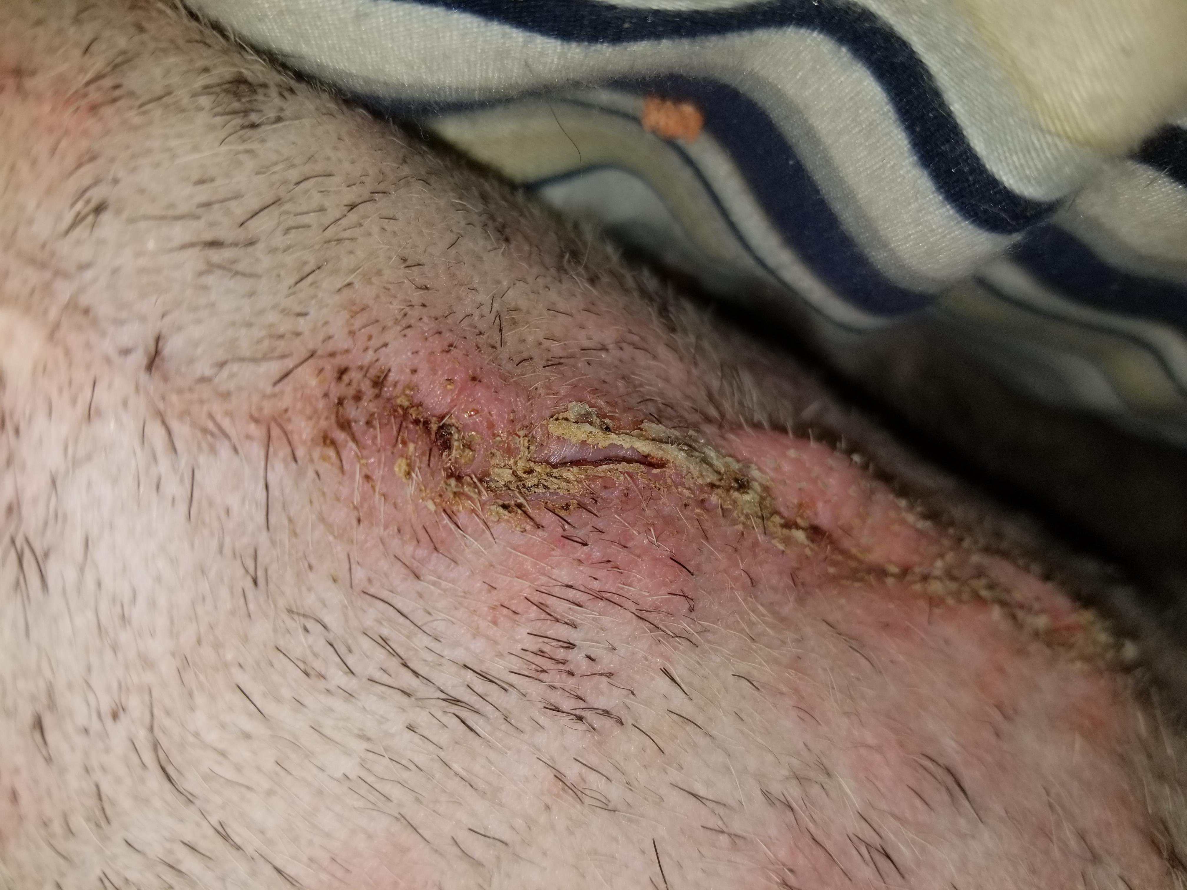 Question details sensitive content