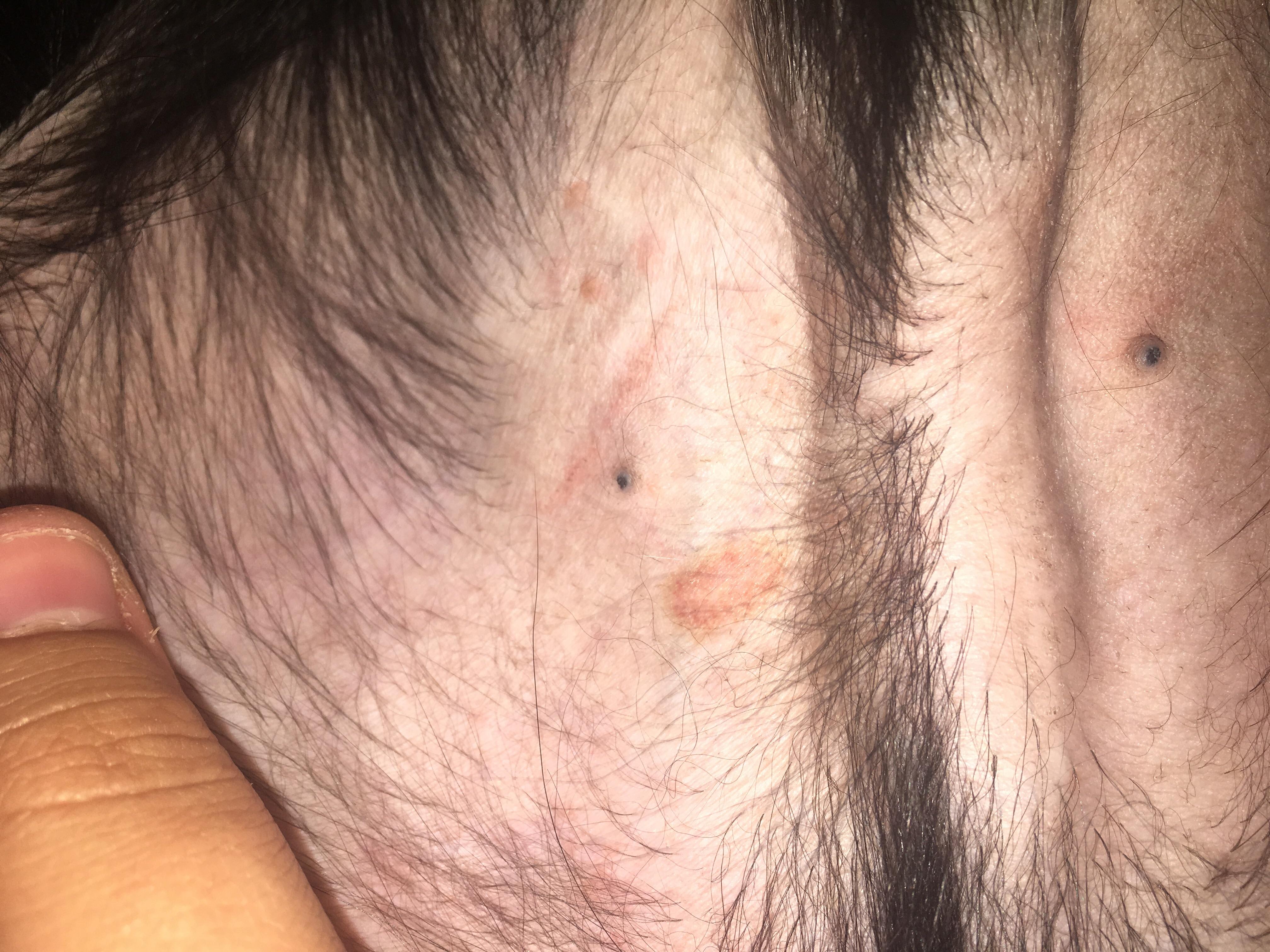 Question details sensitive content