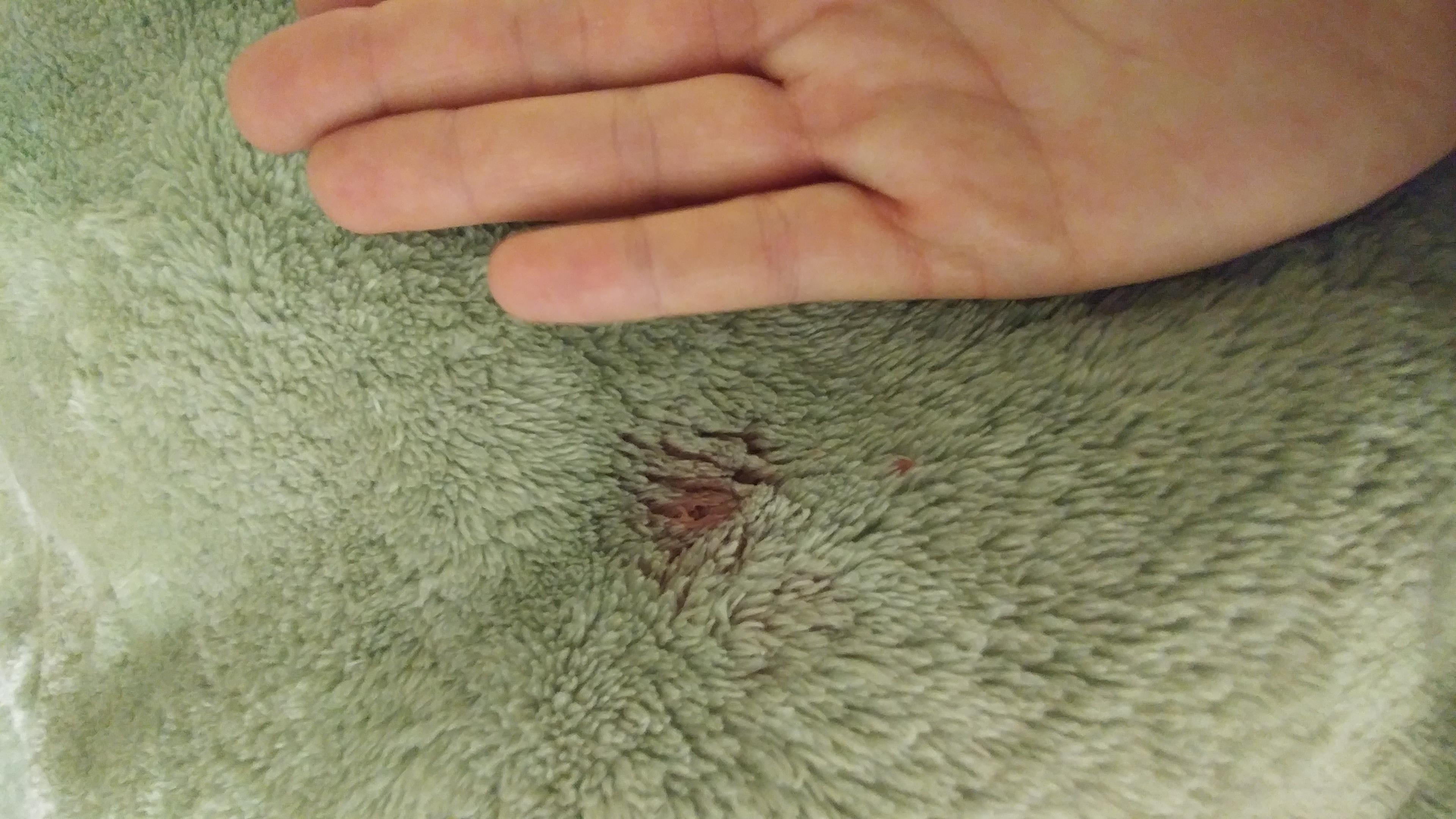 Question details sensitive content