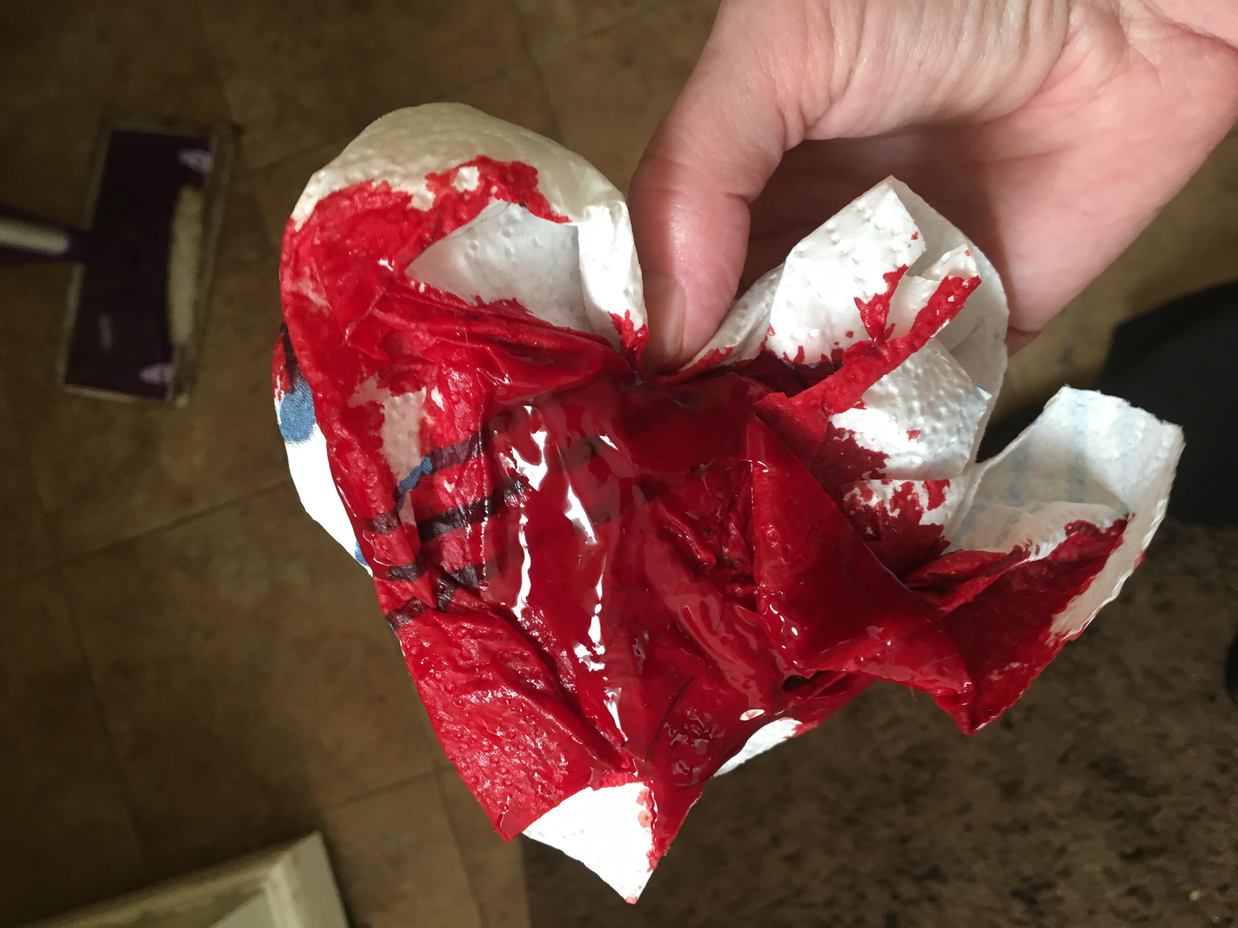 Question details sensitive content