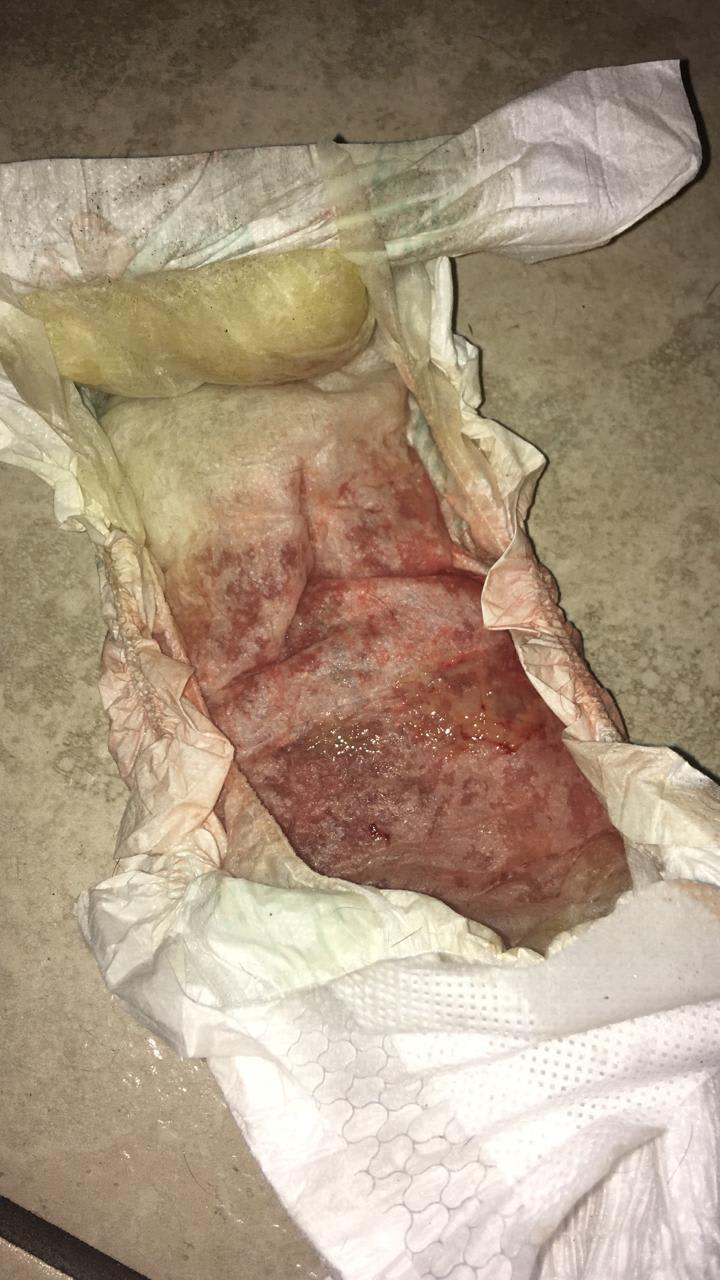 Question details sensitive content