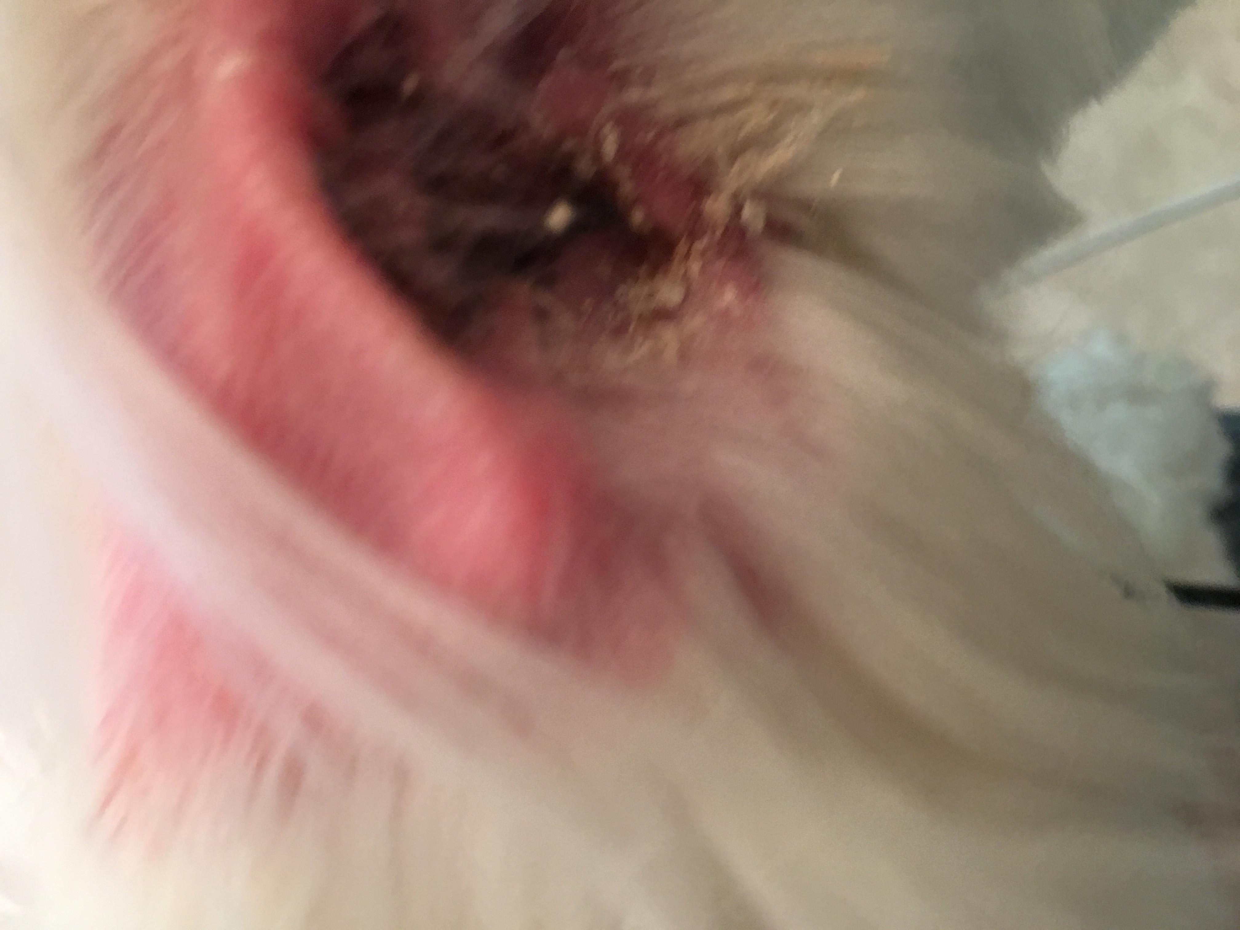 Question details sensitive content