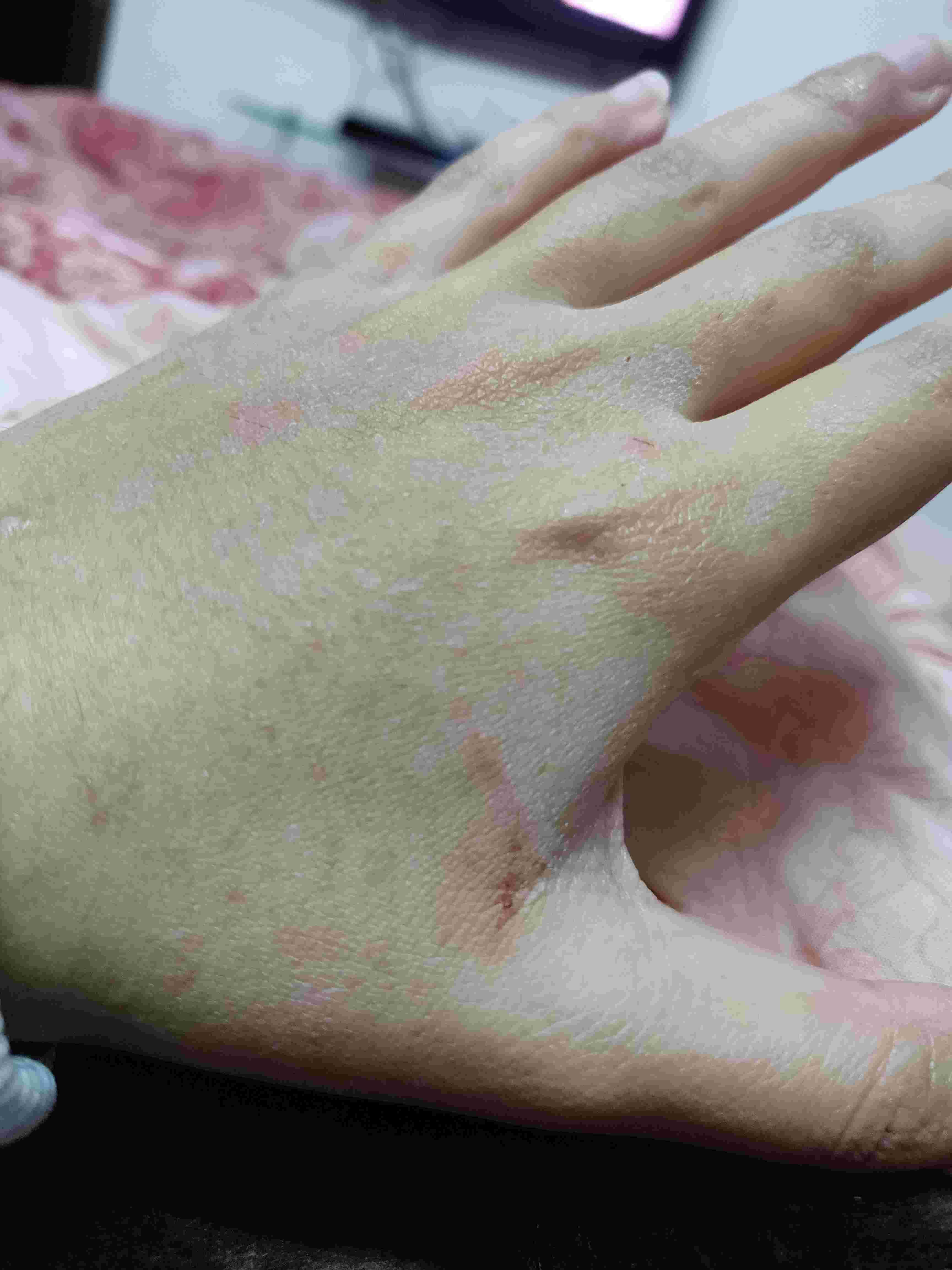 Question details sensitive content