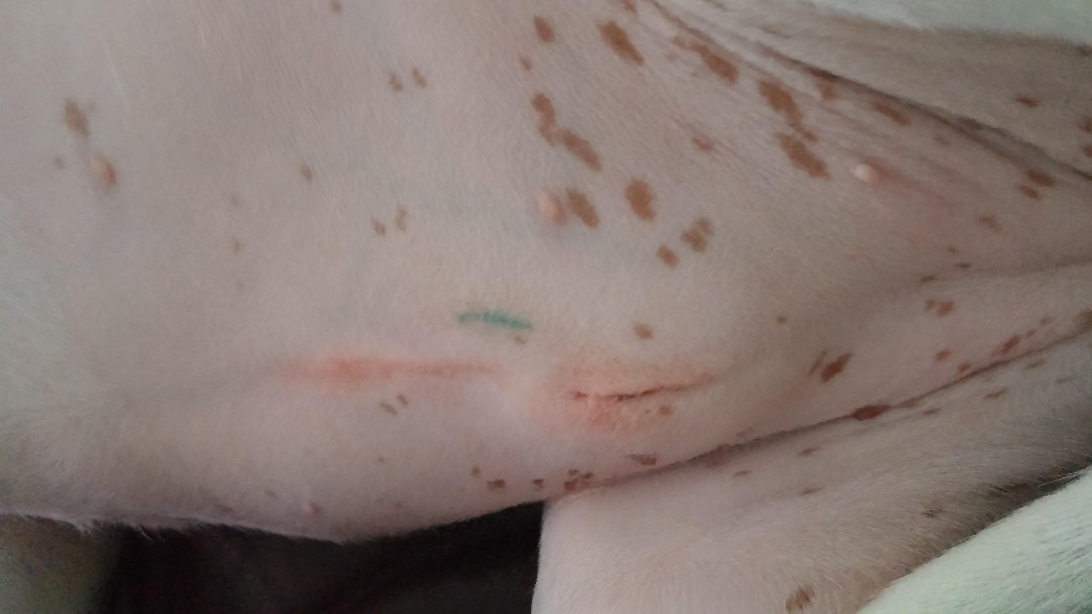 Question details sensitive content