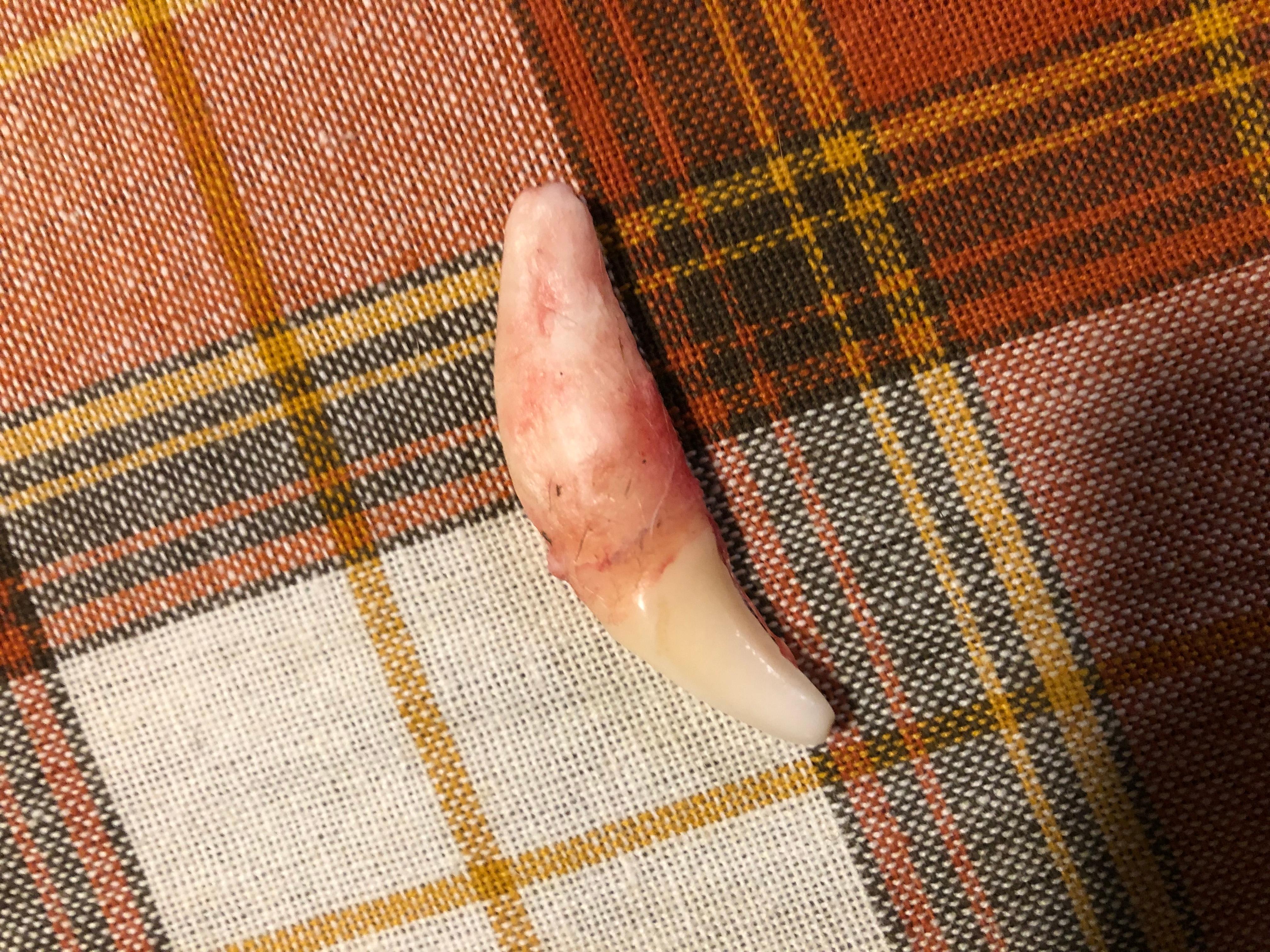 Question details sensitive content